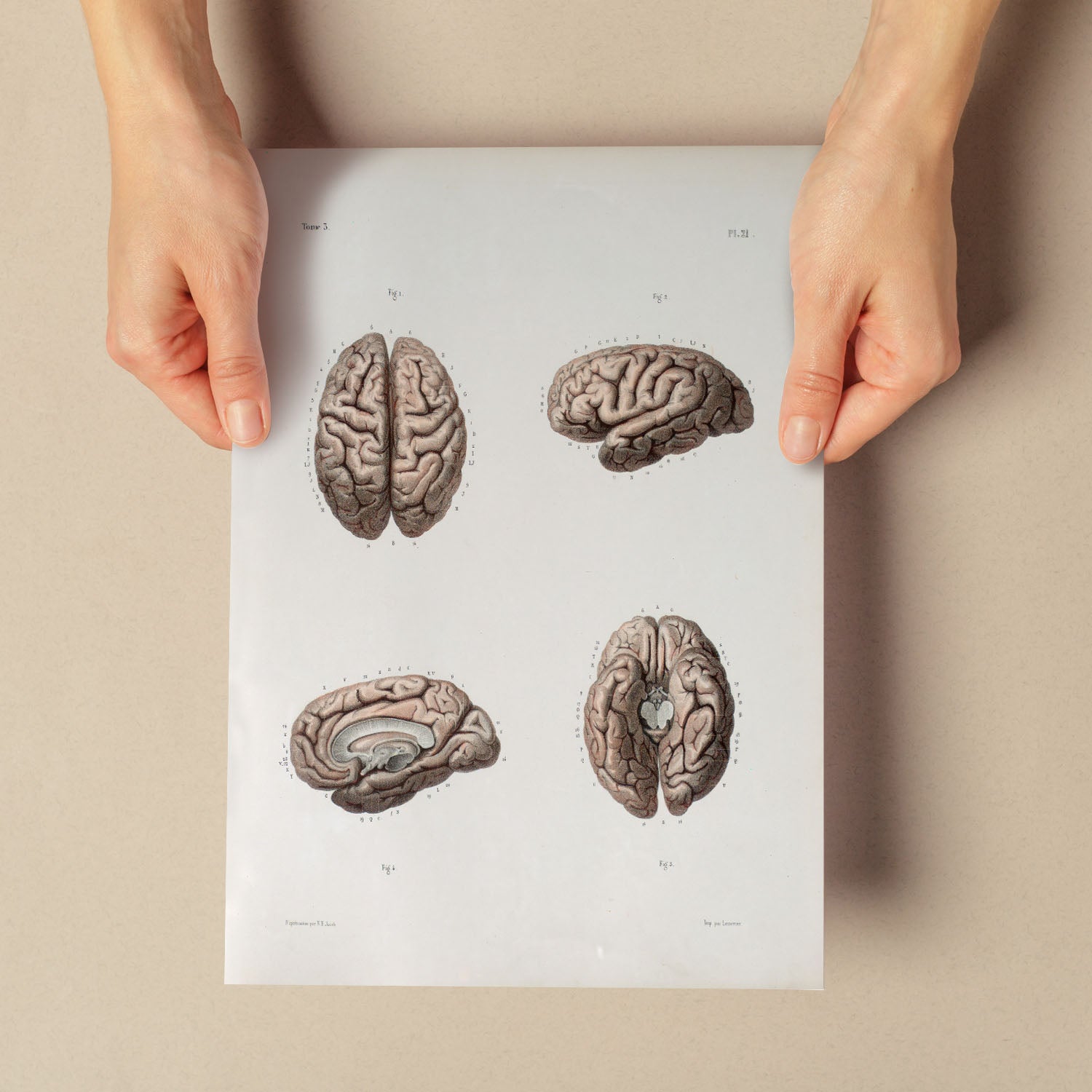 Brain-Artwork-Nacnic-Nacnic Estudio SL