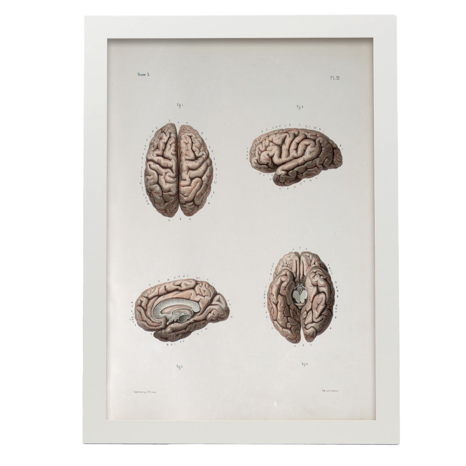 Brain-Artwork-Nacnic-A3-Marco Blanco-Nacnic Estudio SL