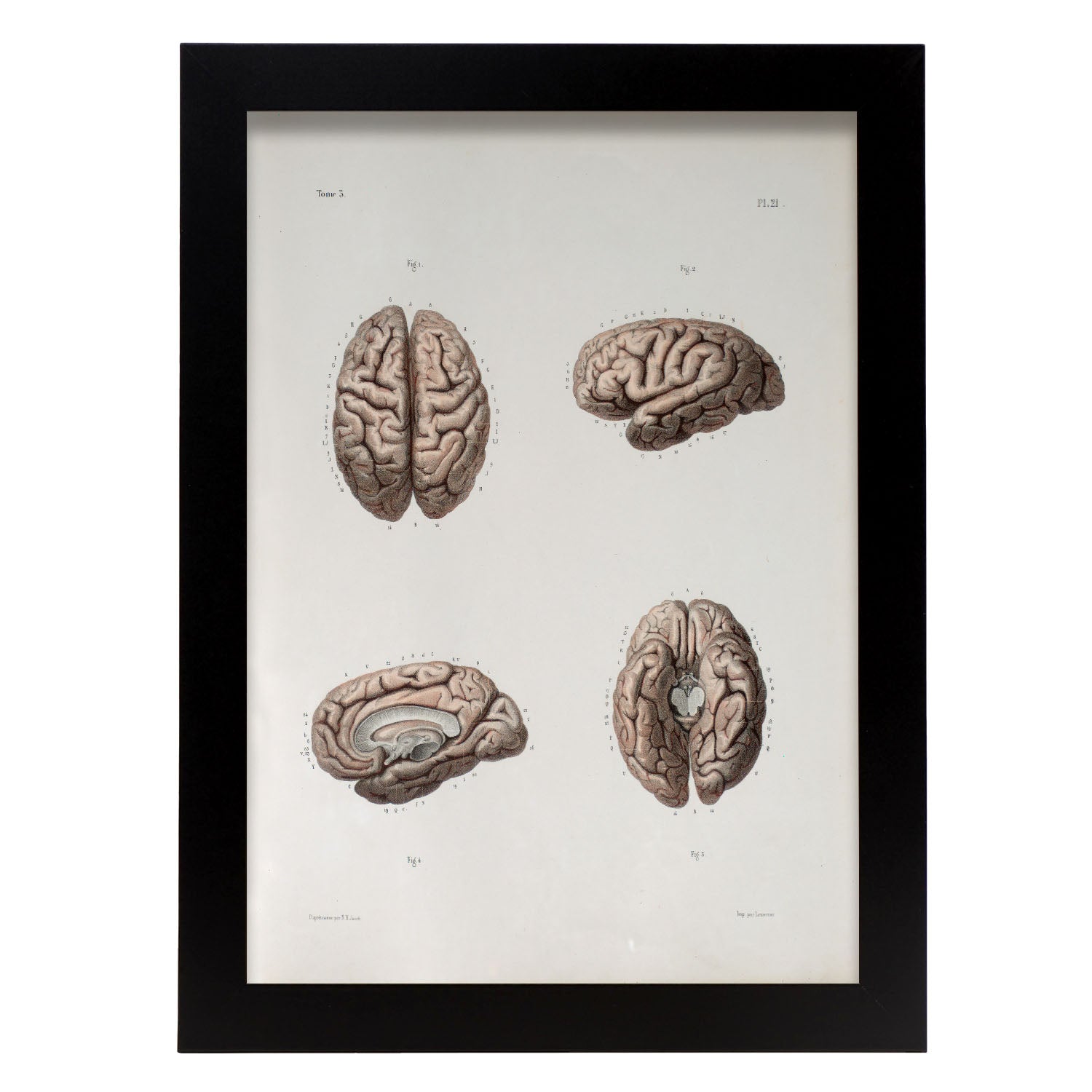 Brain-Artwork-Nacnic-A3-Sin marco-Nacnic Estudio SL