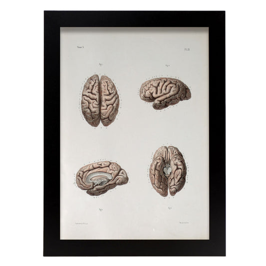 Brain-Artwork-Nacnic-A3-Sin marco-Nacnic Estudio SL