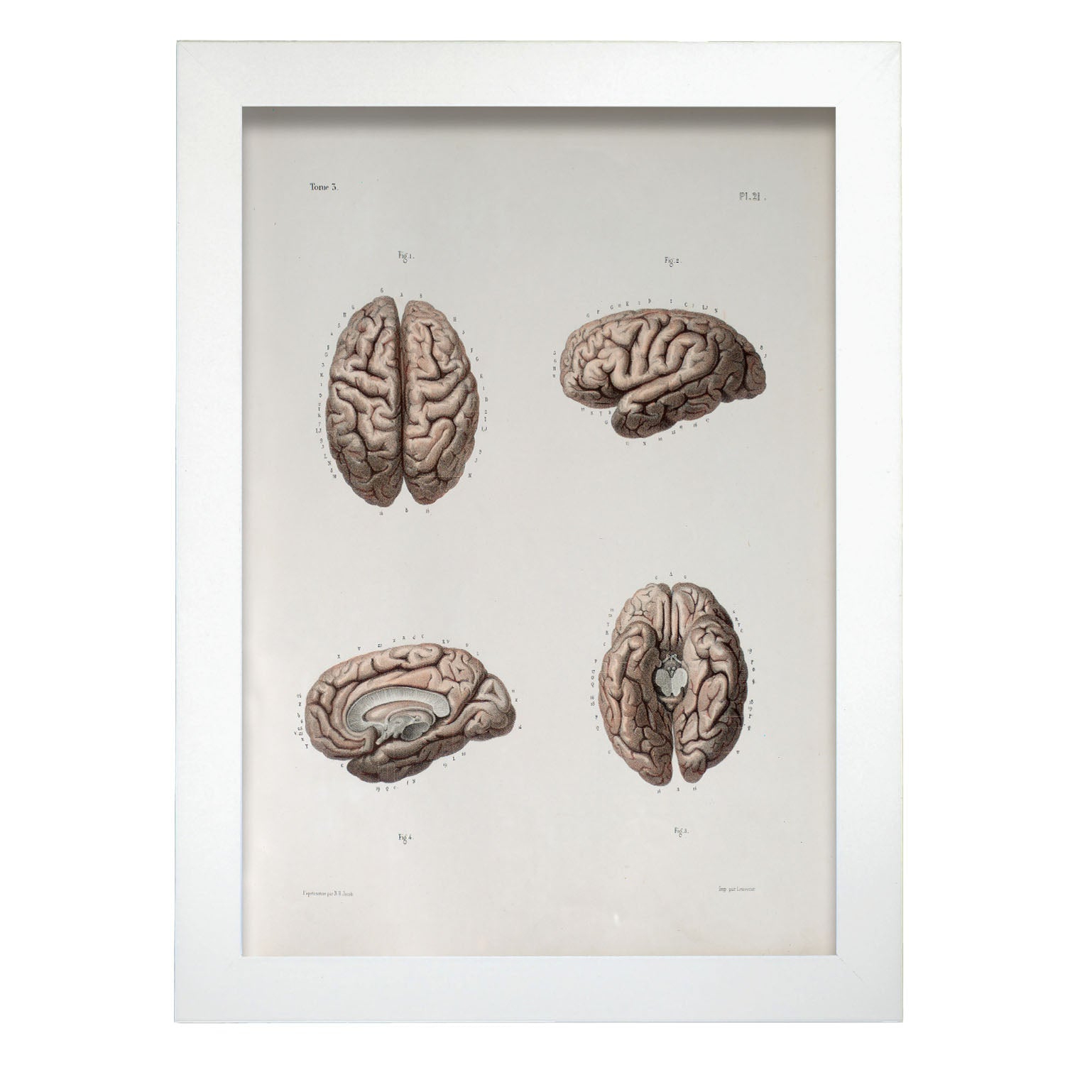 Brain-Artwork-Nacnic-A4-Marco Blanco-Nacnic Estudio SL