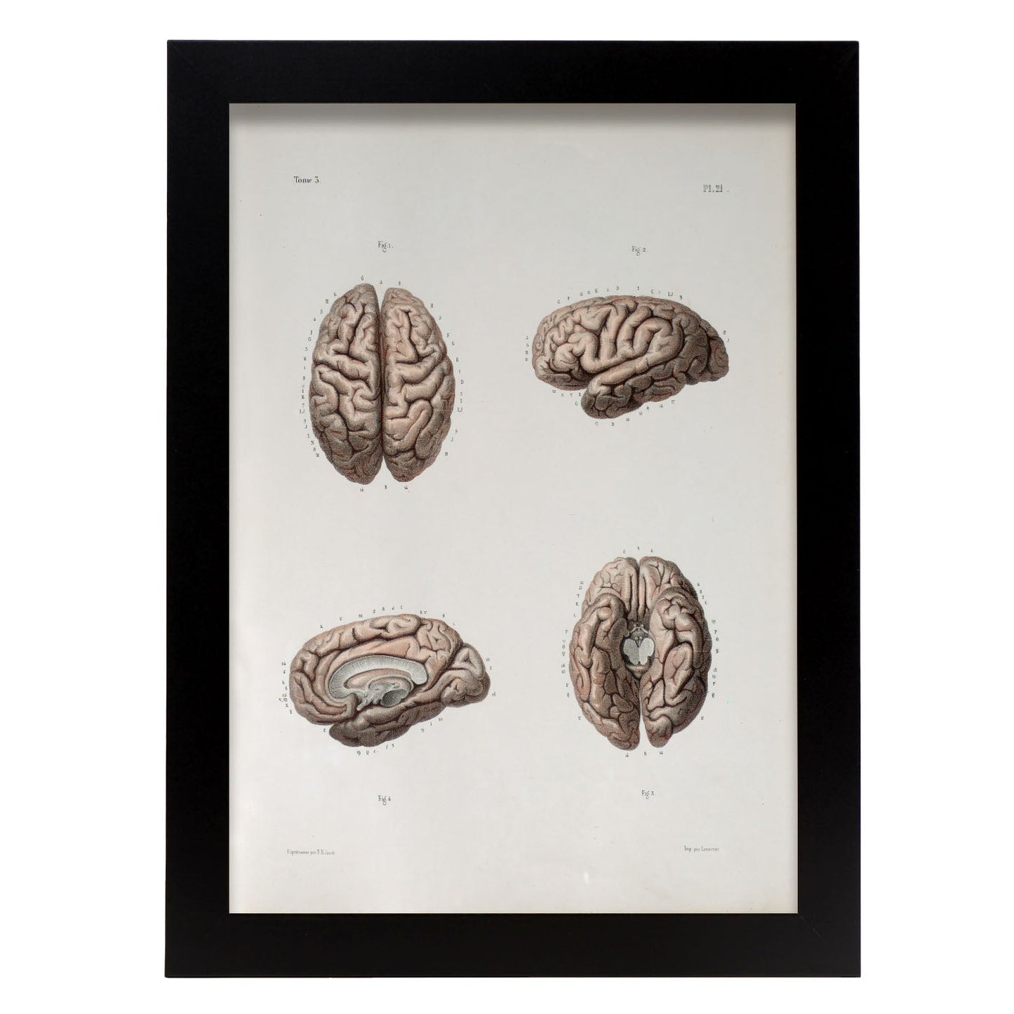 Brain-Artwork-Nacnic-A4-Sin marco-Nacnic Estudio SL