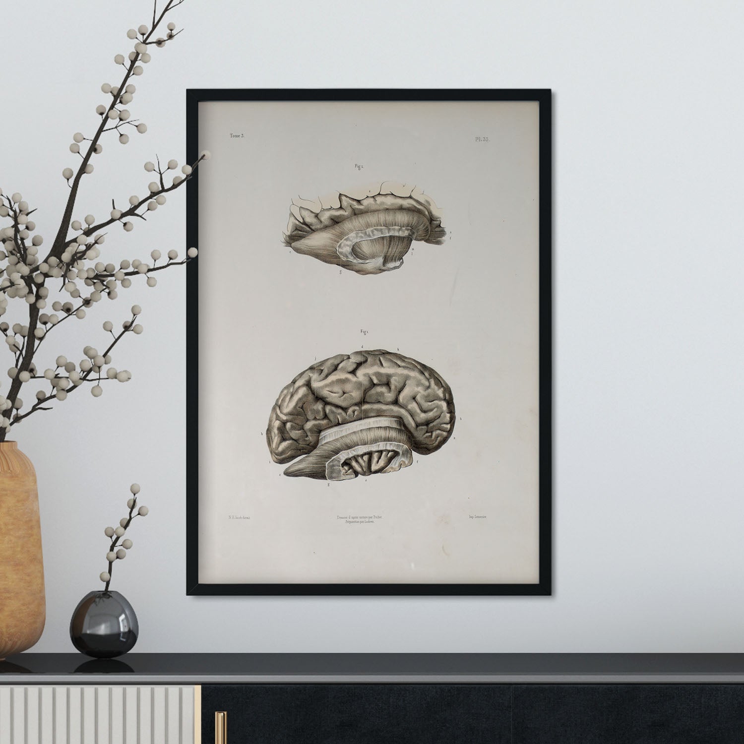 Brain divided in parasagital section-Artwork-Nacnic-Nacnic Estudio SL