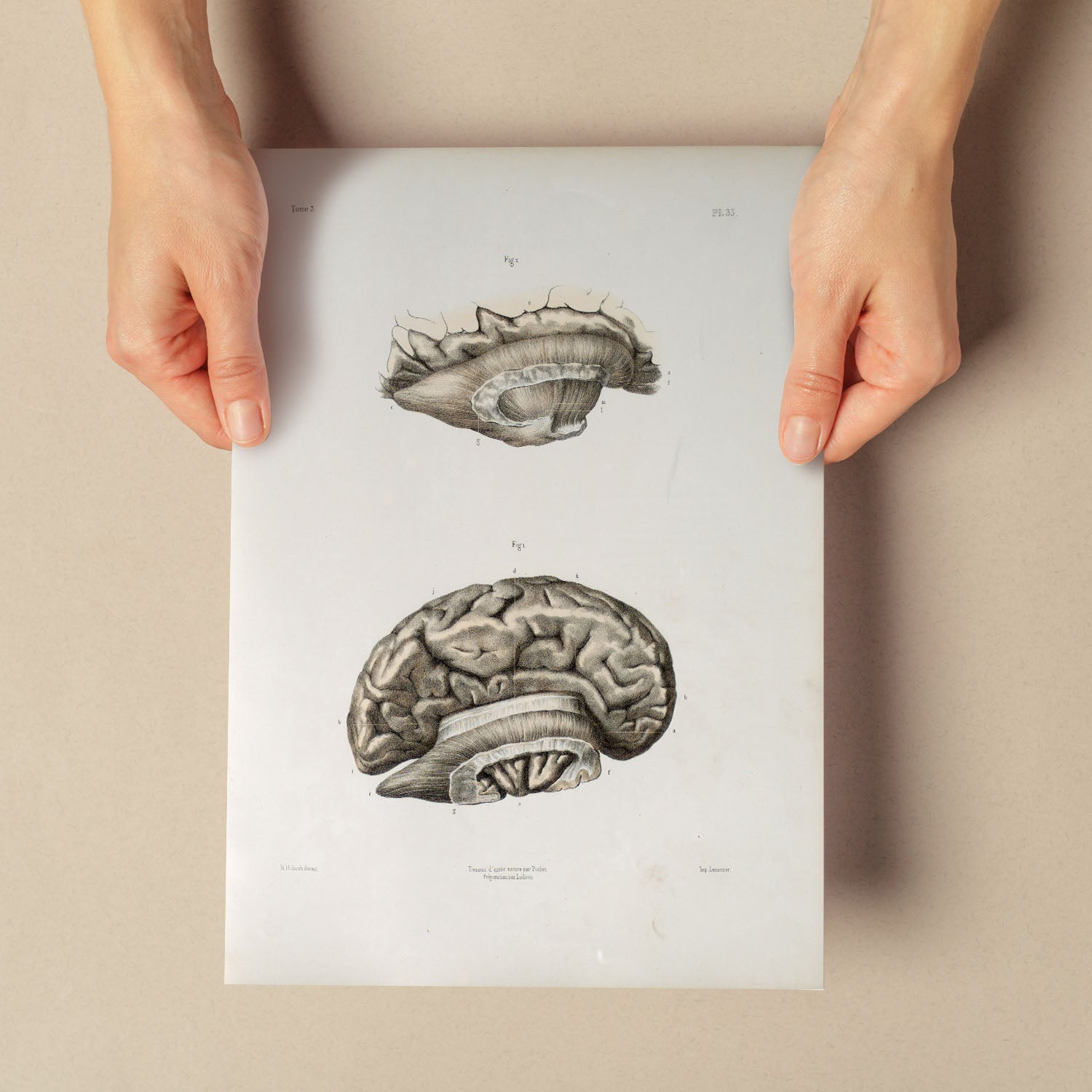 Brain divided in parasagital section-Artwork-Nacnic-Nacnic Estudio SL