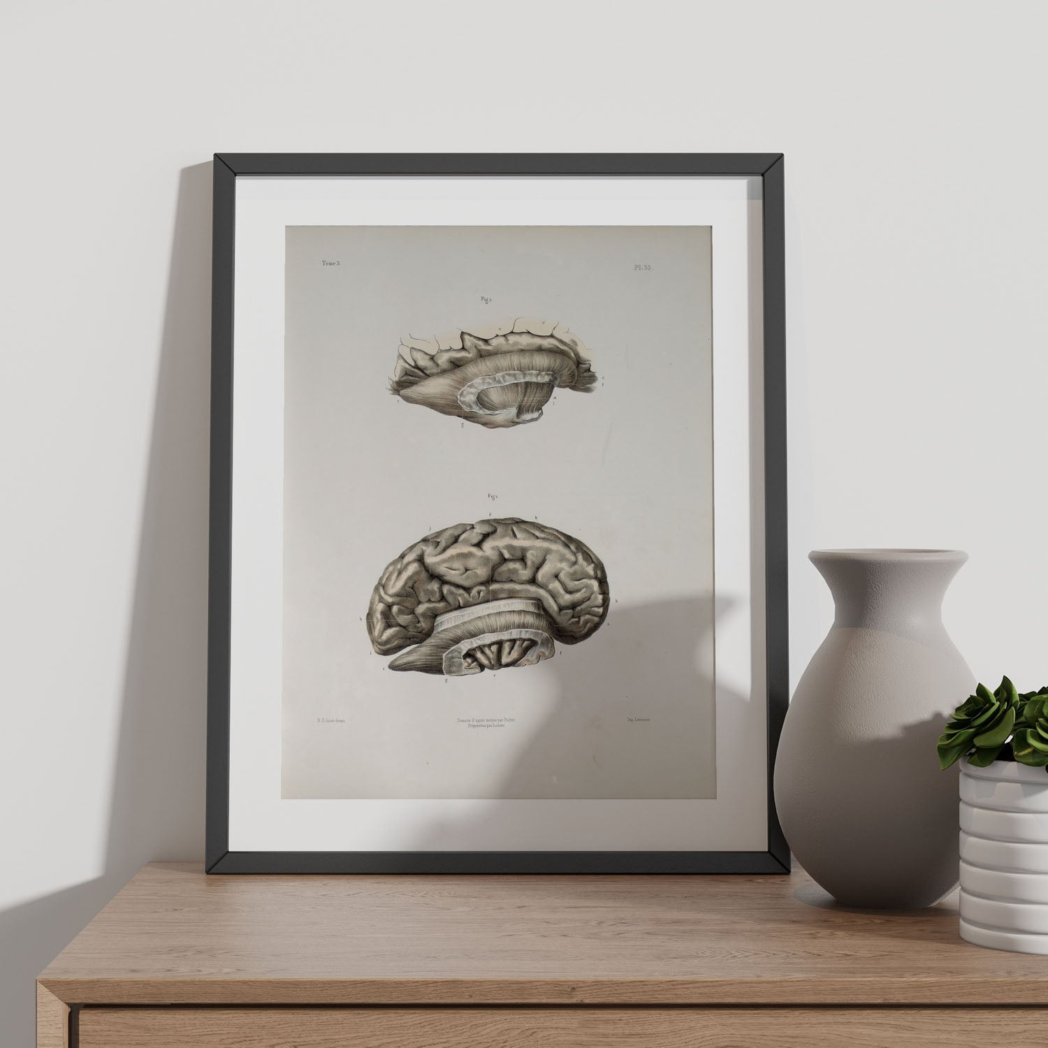 Brain divided in parasagital section-Artwork-Nacnic-Nacnic Estudio SL