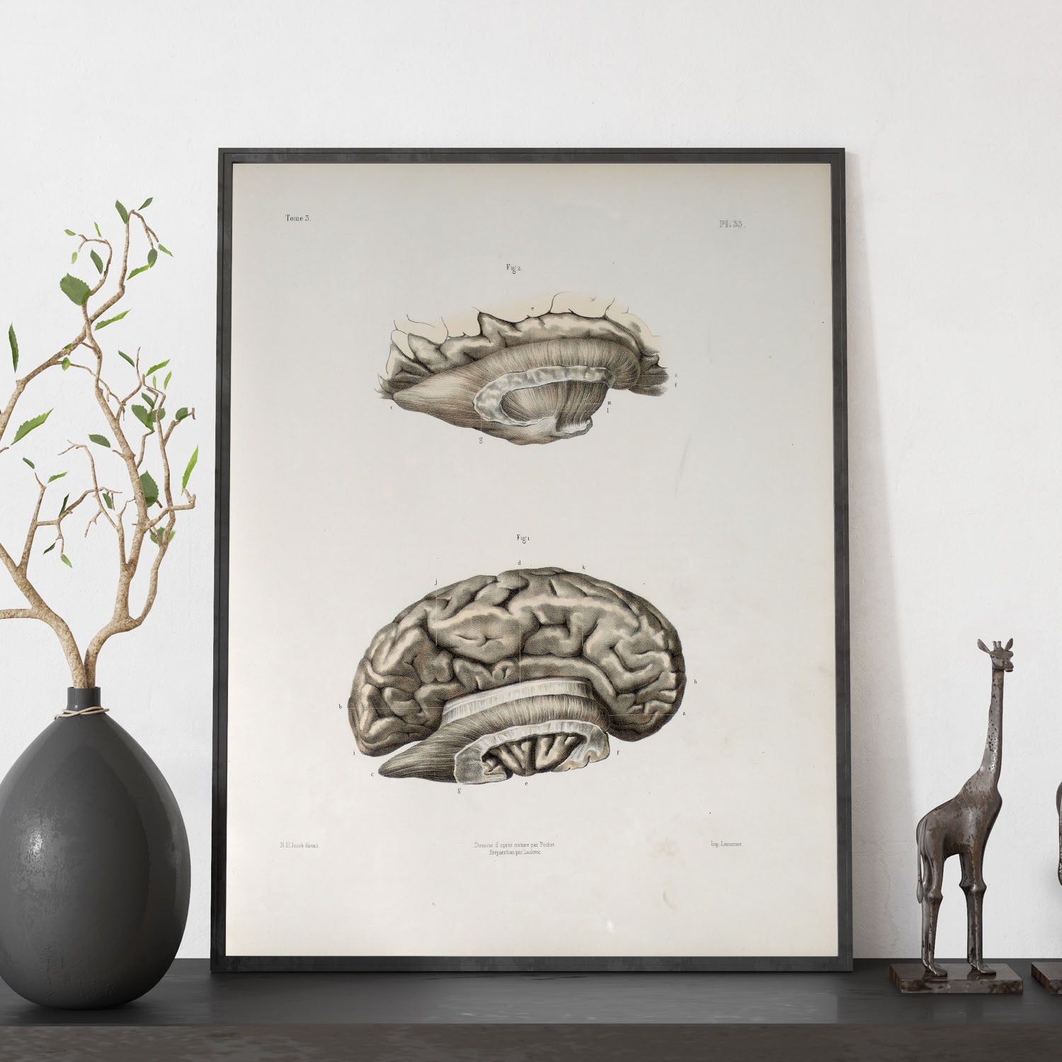 Brain divided in parasagital section-Artwork-Nacnic-Nacnic Estudio SL