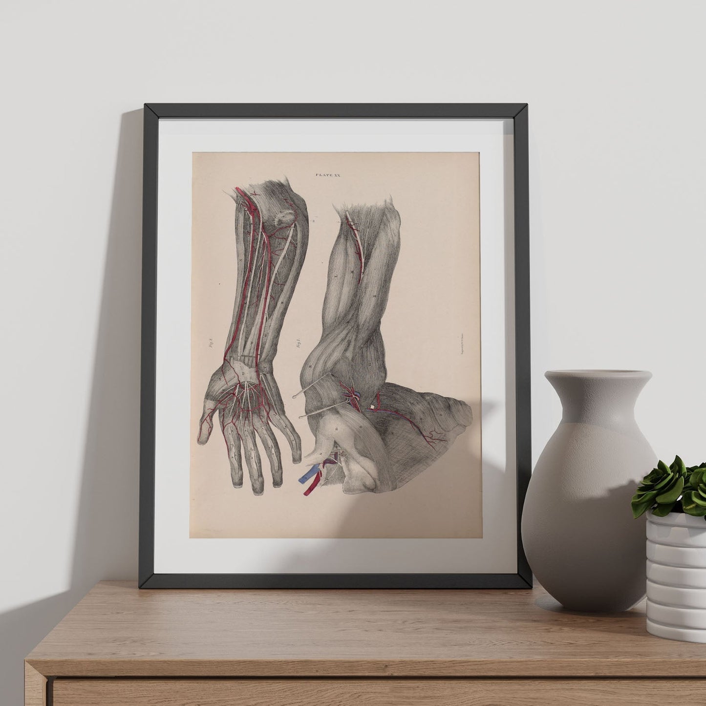 Dissection of the arm and hand-Artwork-Nacnic-Nacnic Estudio SL
