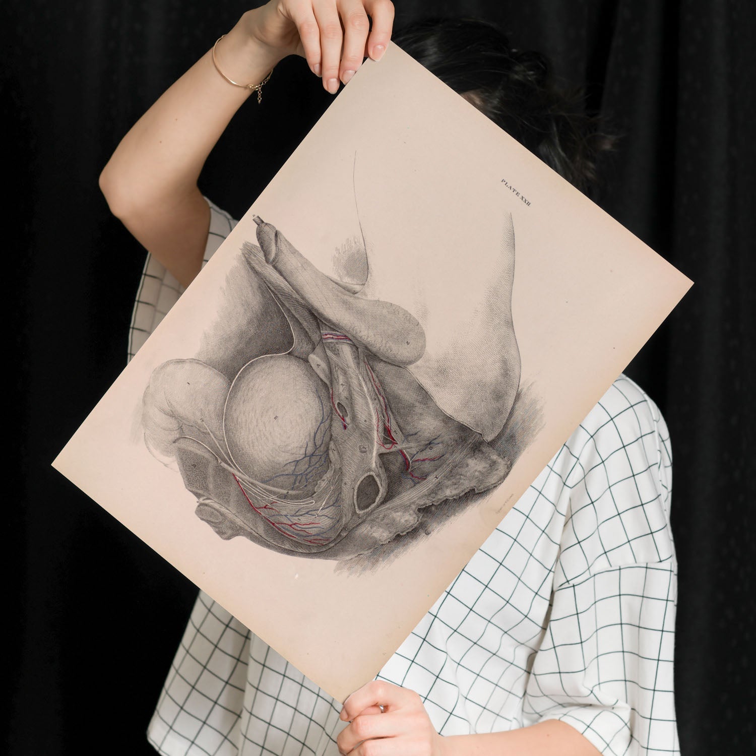 Dissection of the pelvis, urogenital system, male-Artwork-Nacnic-Nacnic Estudio SL