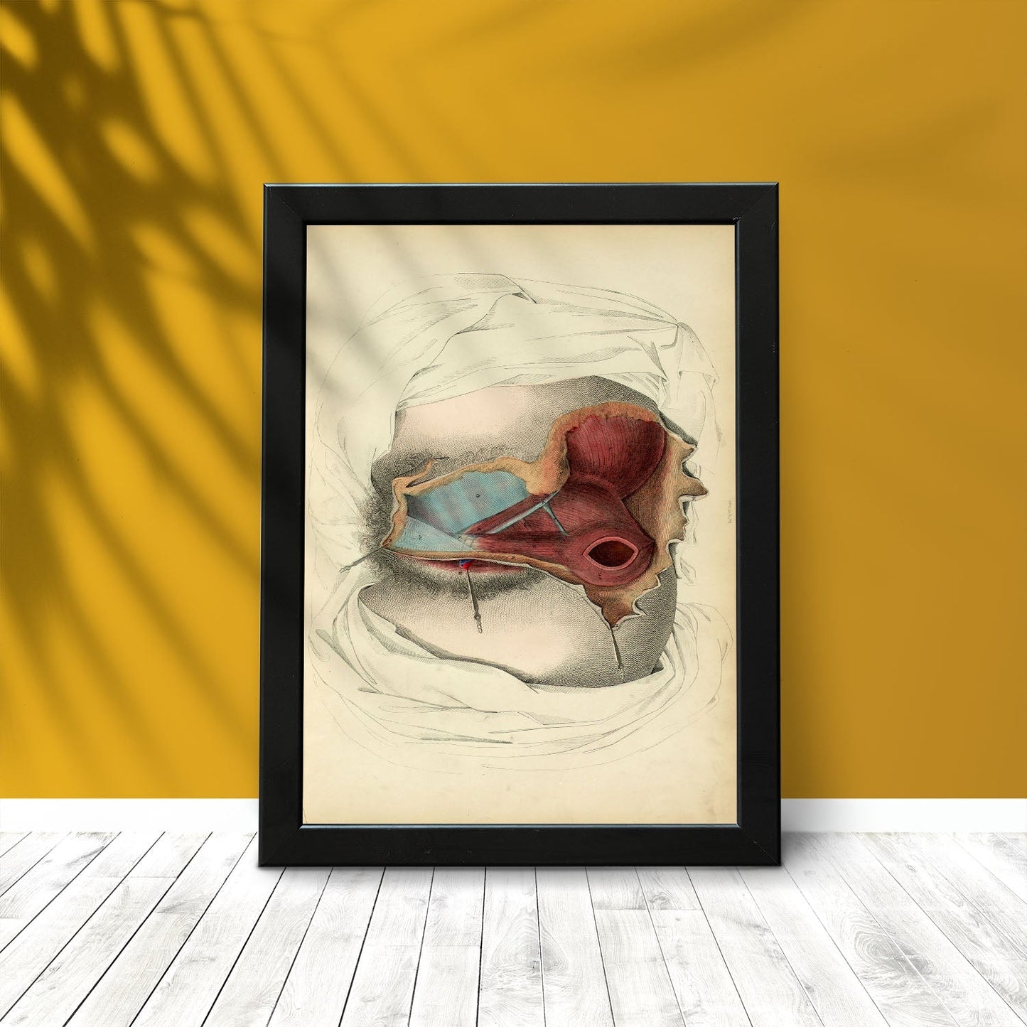 Dissection of the perineum, female-Artwork-Nacnic-Nacnic Estudio SL