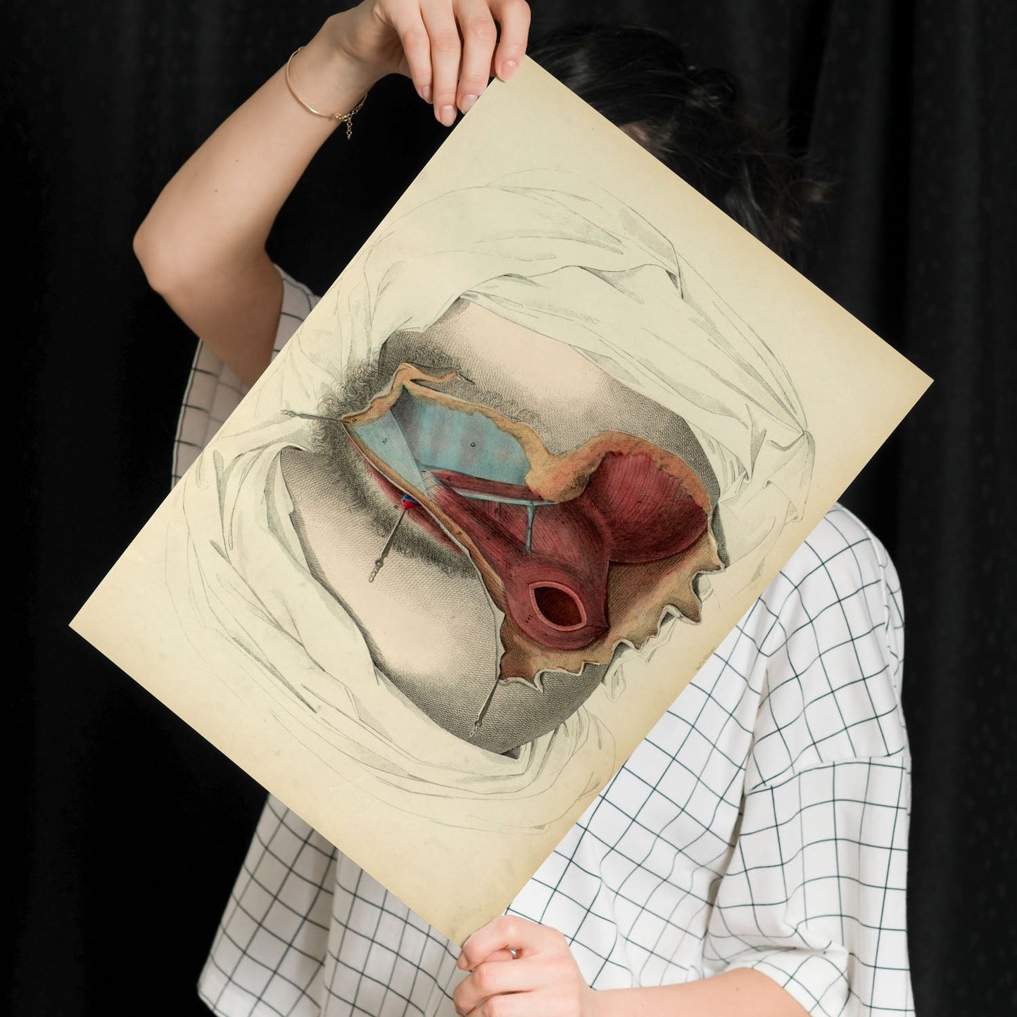 Dissection of the perineum, female-Artwork-Nacnic-Nacnic Estudio SL