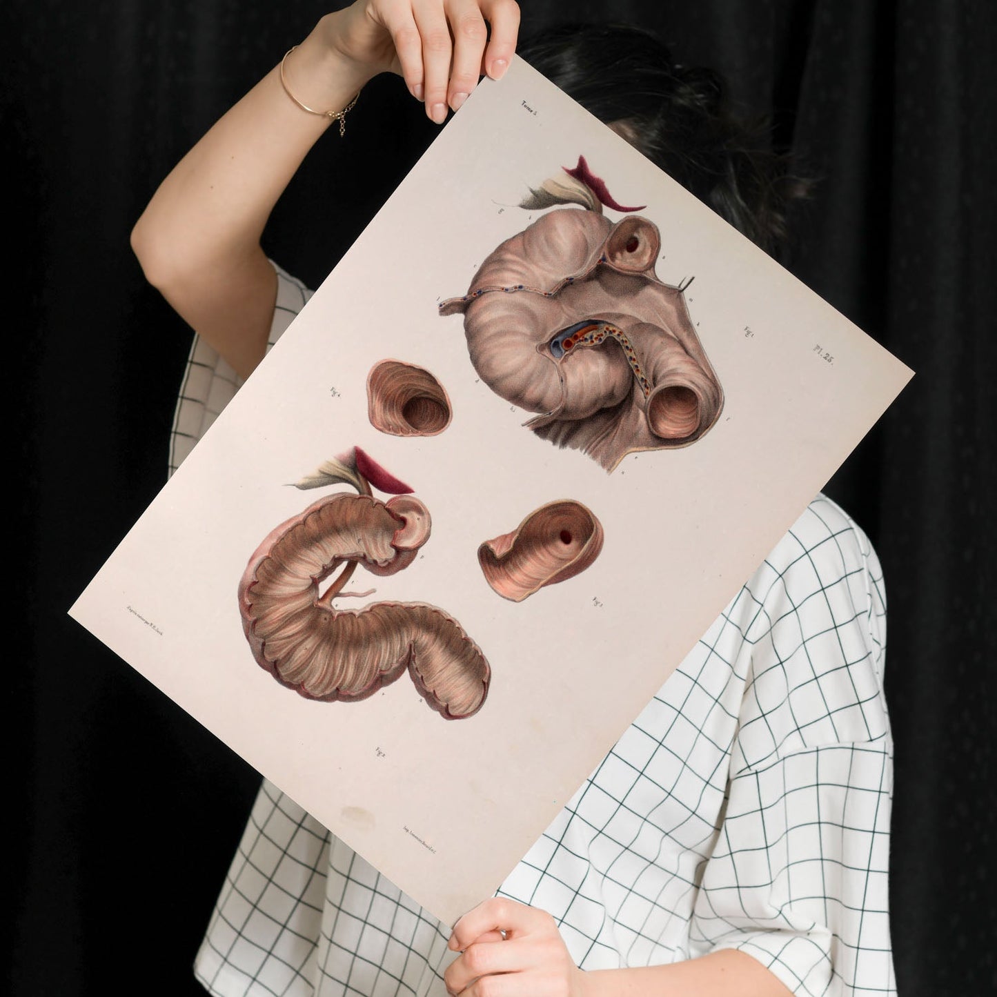 Duodenum-Artwork-Nacnic-Nacnic Estudio SL