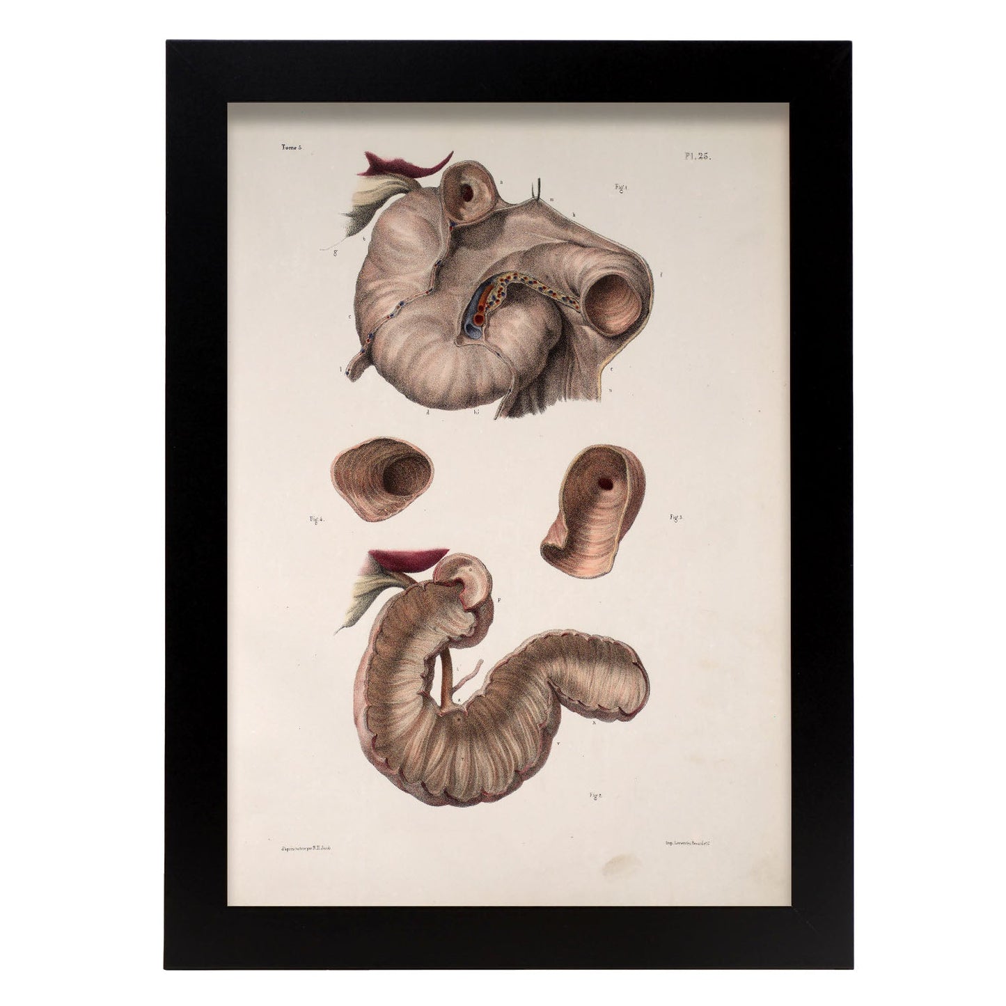 Duodenum-Artwork-Nacnic-A3-Sin marco-Nacnic Estudio SL