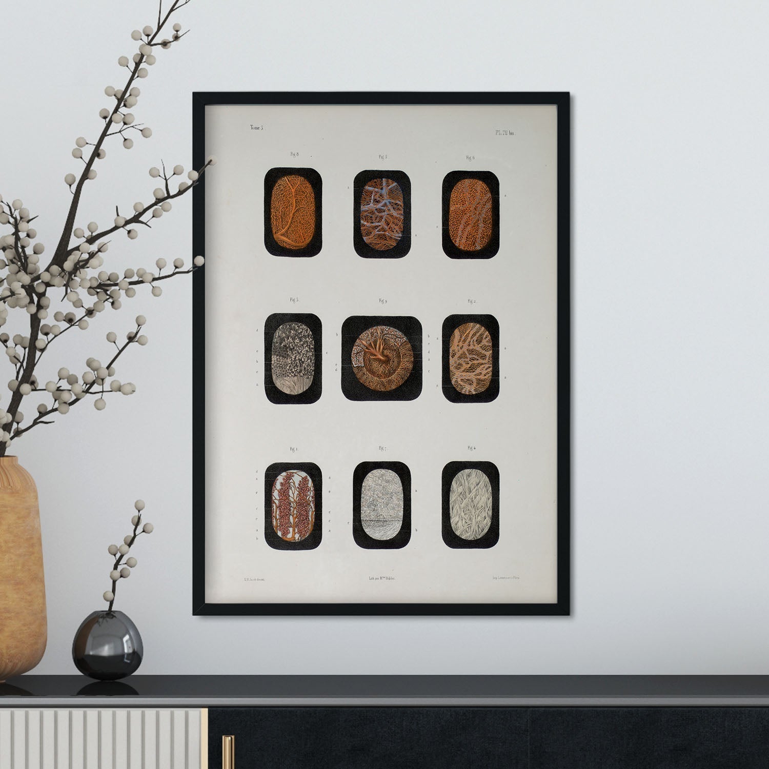 Eye, dissected and shown under a microscope-Artwork-Nacnic-Nacnic Estudio SL