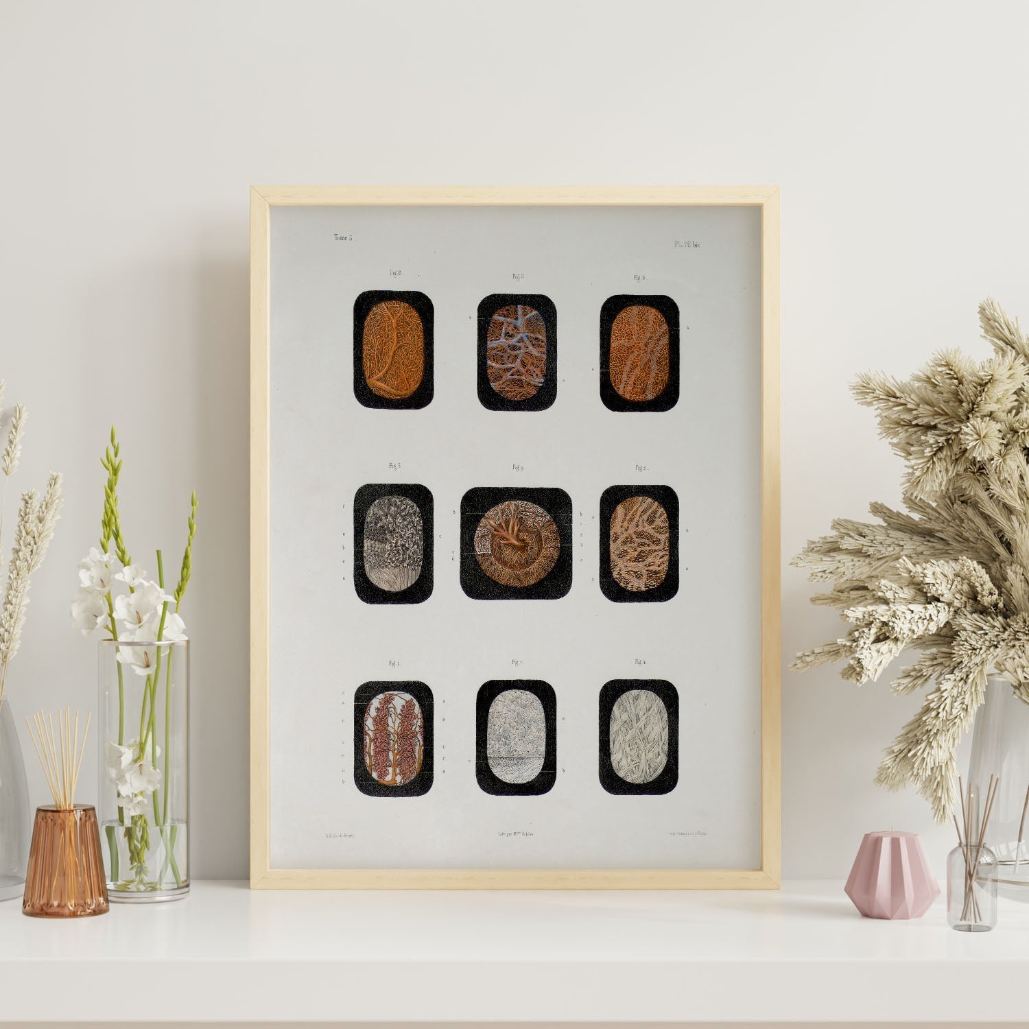 Eye, dissected and shown under a microscope-Artwork-Nacnic-Nacnic Estudio SL