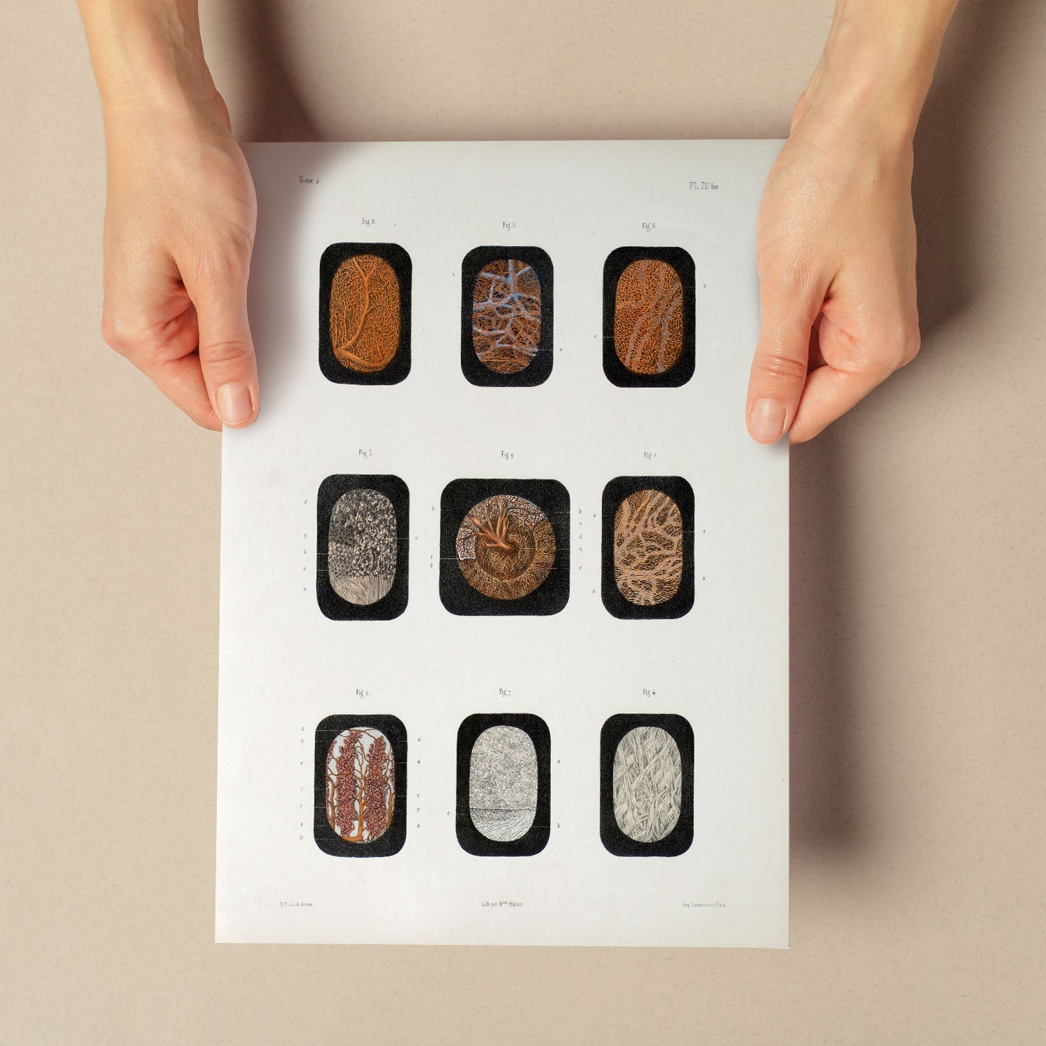 Eye, dissected and shown under a microscope-Artwork-Nacnic-Nacnic Estudio SL