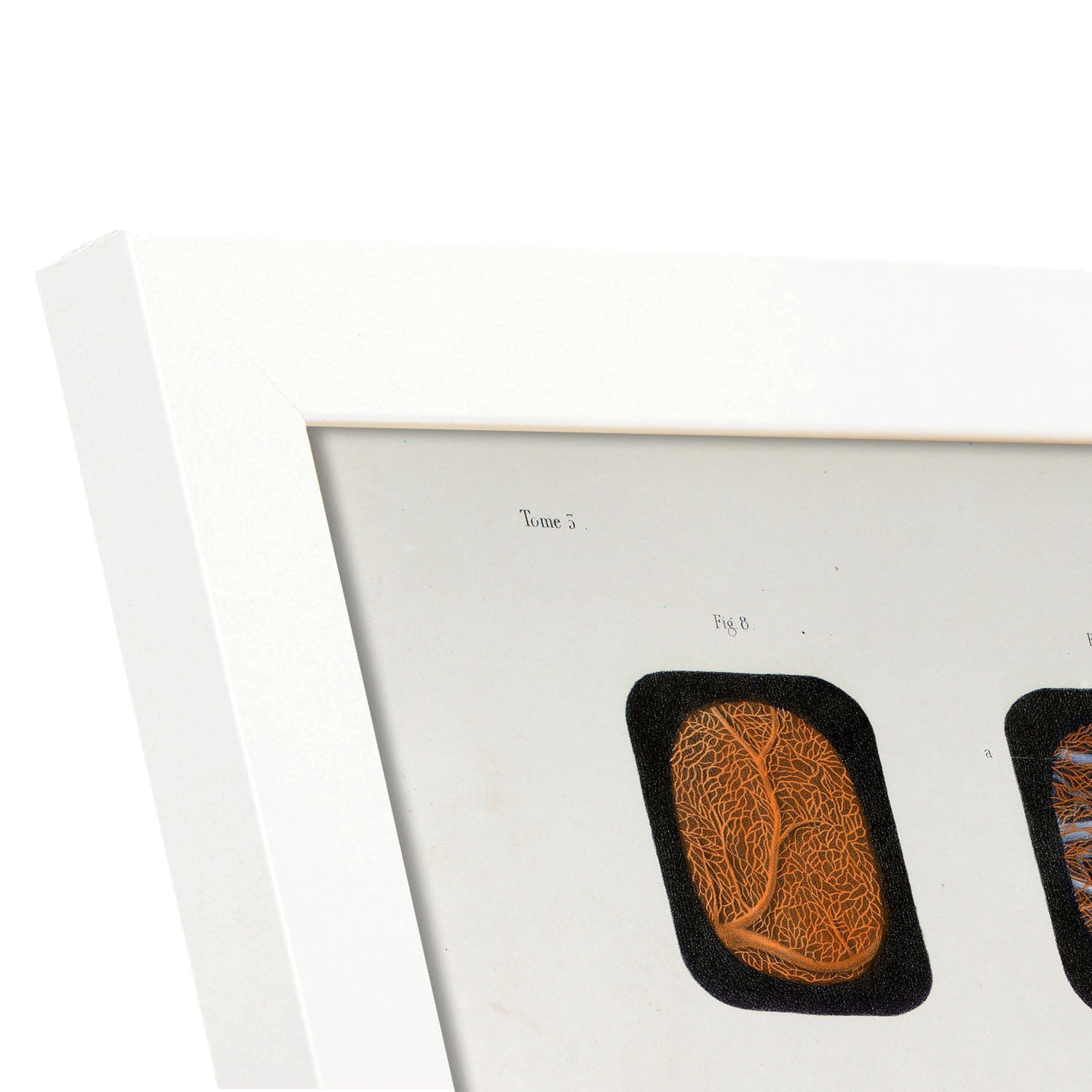 Eye, dissected and shown under a microscope-Artwork-Nacnic-Nacnic Estudio SL