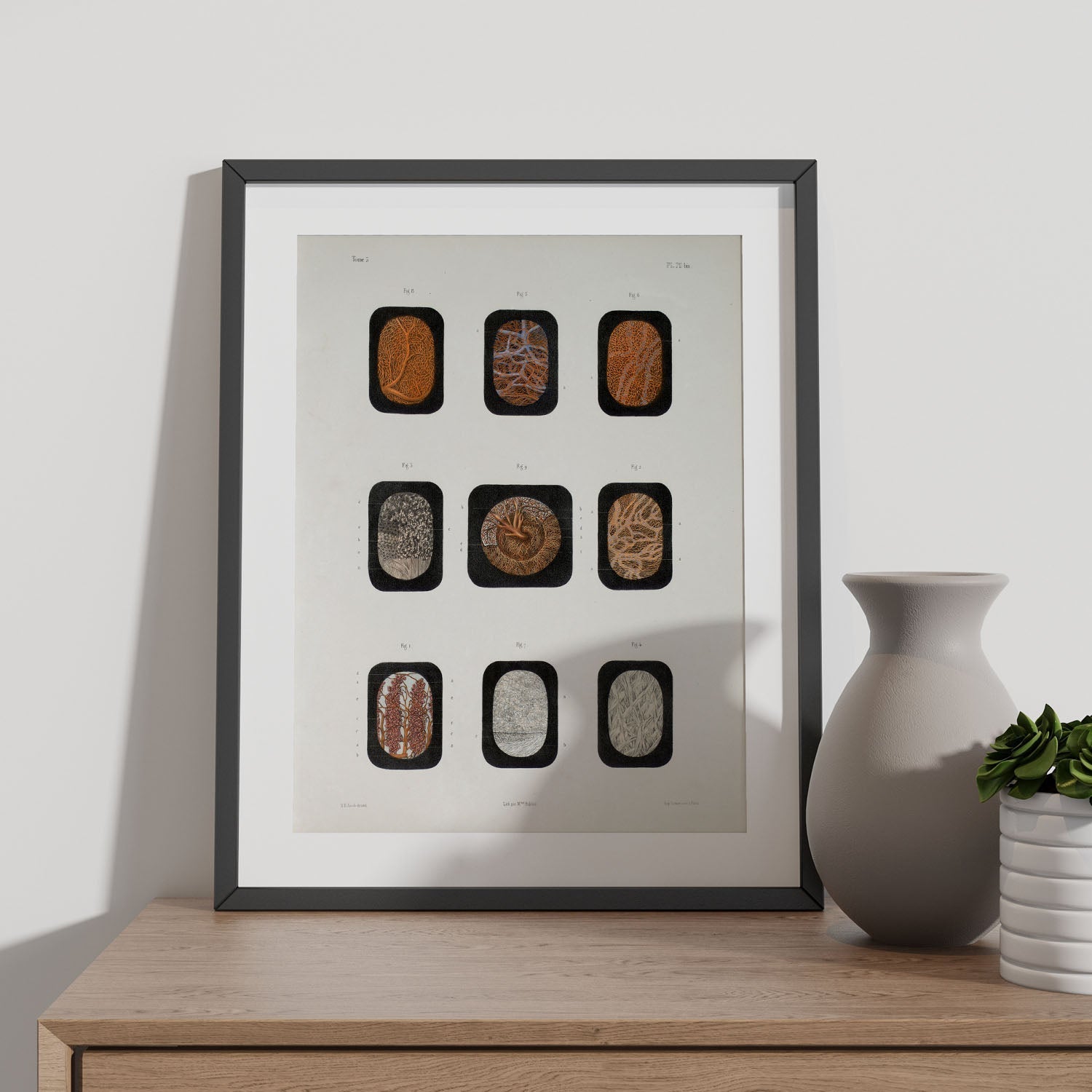 Eye, dissected and shown under a microscope-Artwork-Nacnic-Nacnic Estudio SL