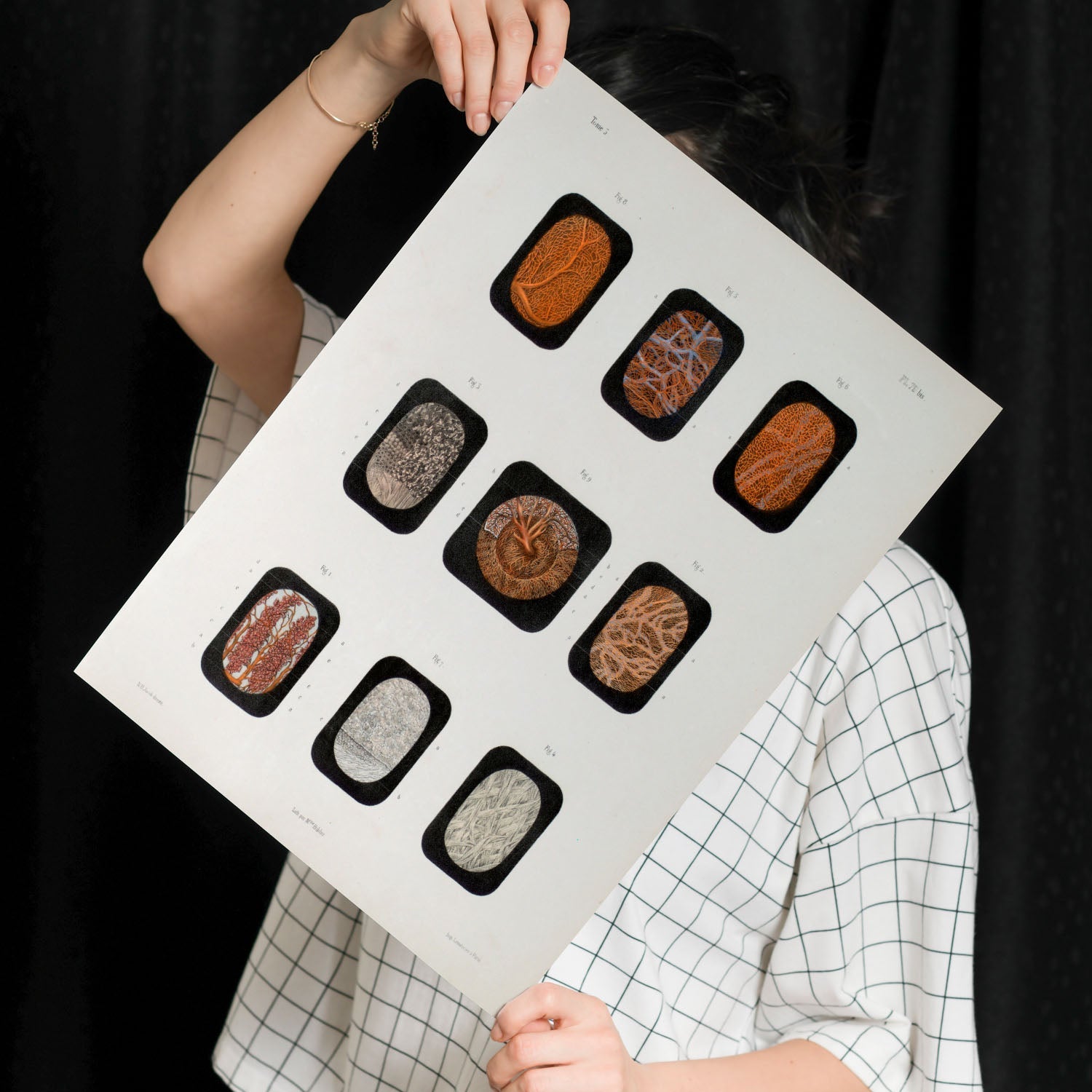 Eye, dissected and shown under a microscope-Artwork-Nacnic-Nacnic Estudio SL