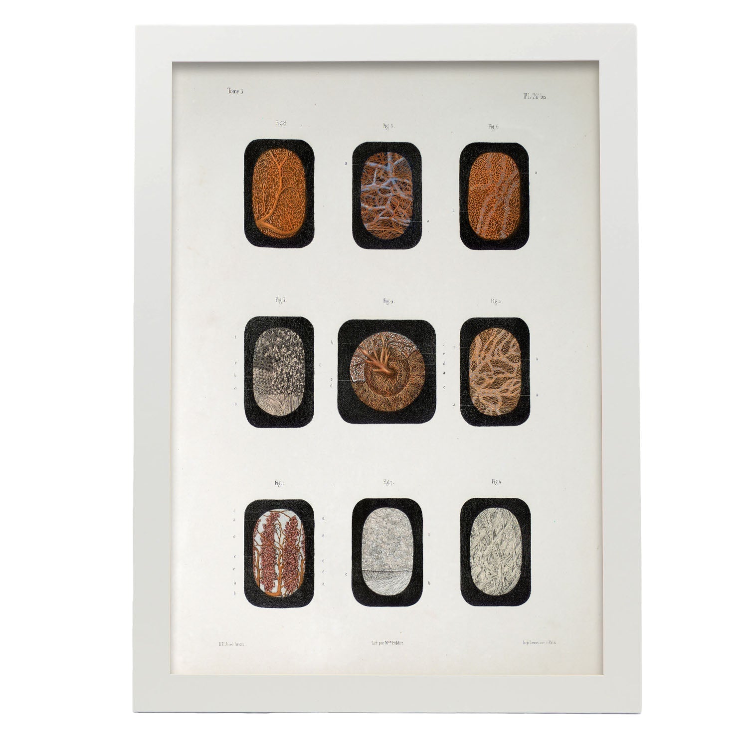 Eye, dissected and shown under a microscope-Artwork-Nacnic-A3-Marco Blanco-Nacnic Estudio SL