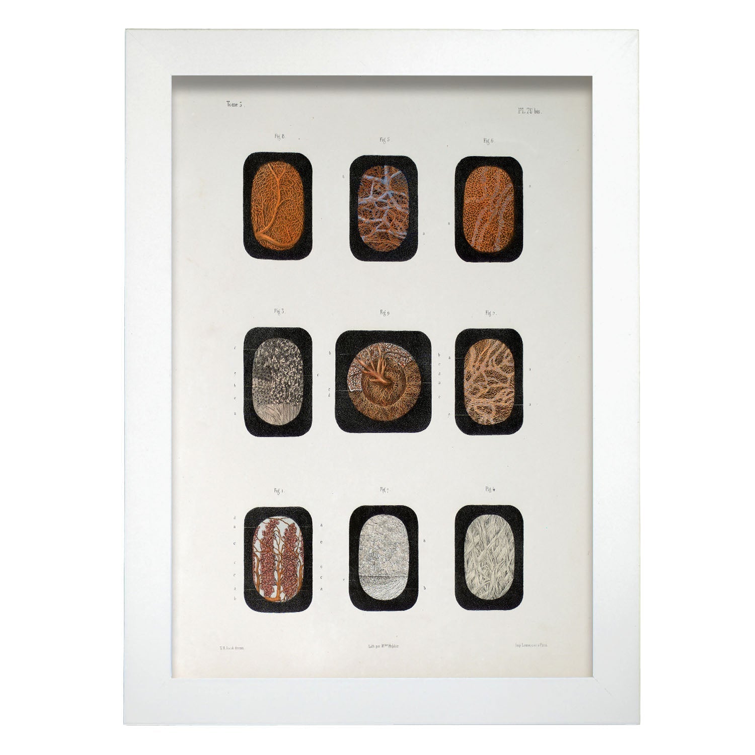 Eye, dissected and shown under a microscope-Artwork-Nacnic-A4-Marco Blanco-Nacnic Estudio SL