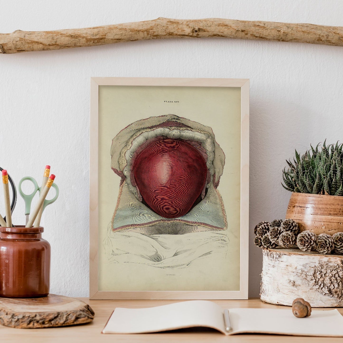 Gravid uterus-Artwork-Nacnic-Nacnic Estudio SL