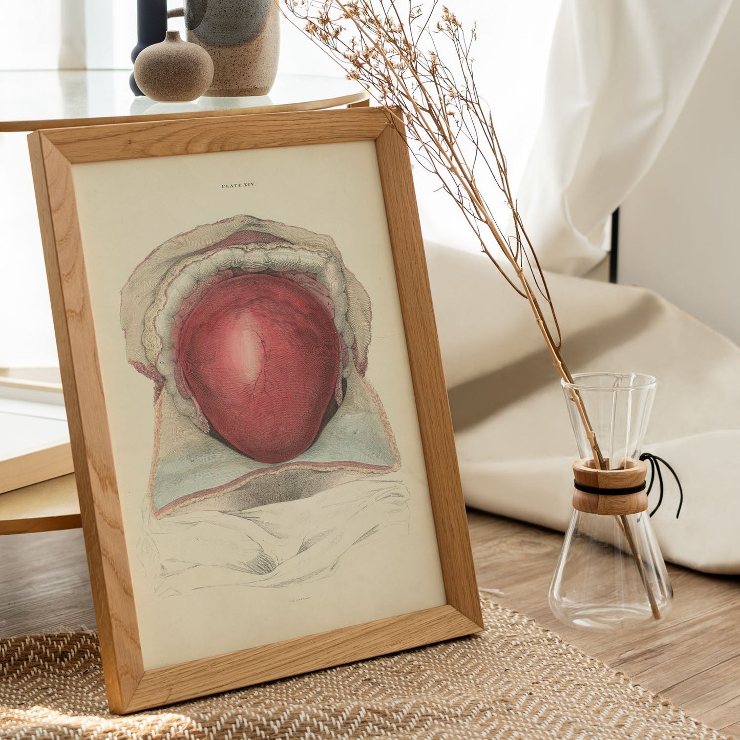 Gravid uterus-Artwork-Nacnic-Nacnic Estudio SL