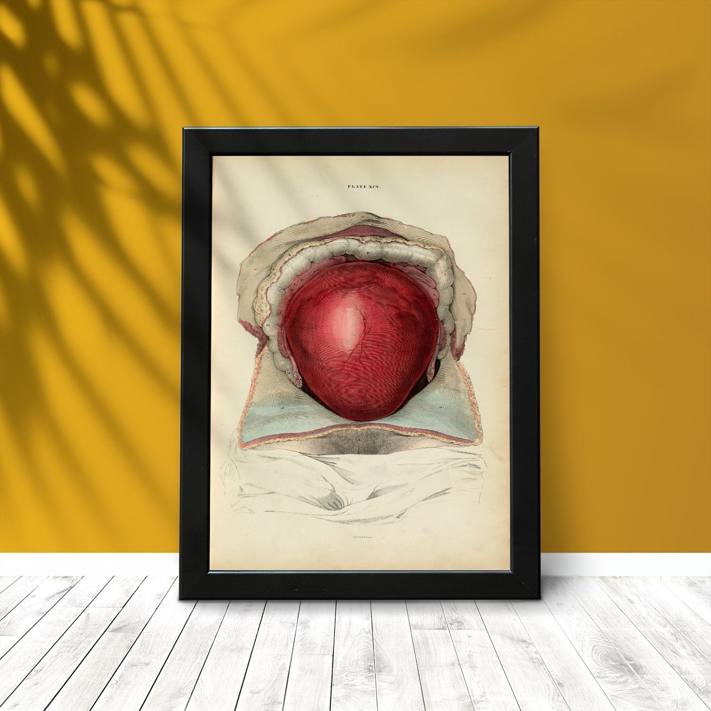 Gravid uterus-Artwork-Nacnic-Nacnic Estudio SL