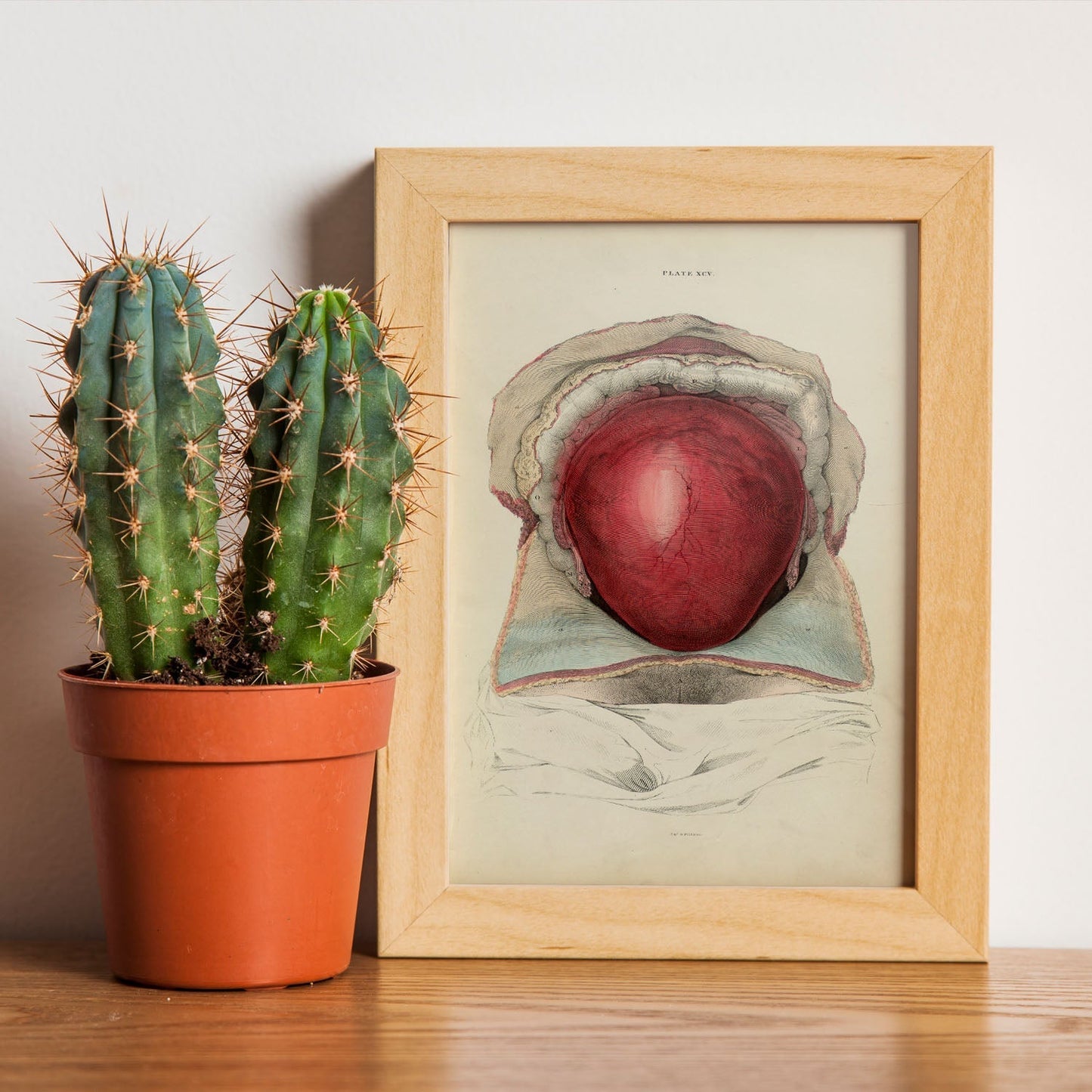 Gravid uterus-Artwork-Nacnic-Nacnic Estudio SL
