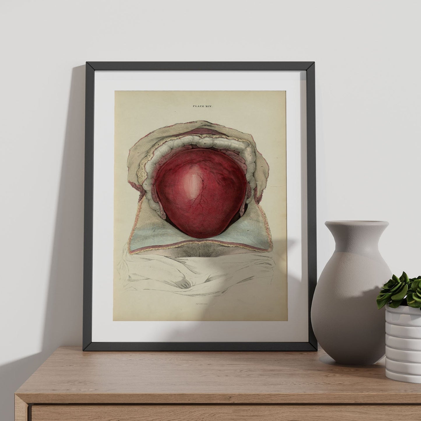 Gravid uterus-Artwork-Nacnic-Nacnic Estudio SL