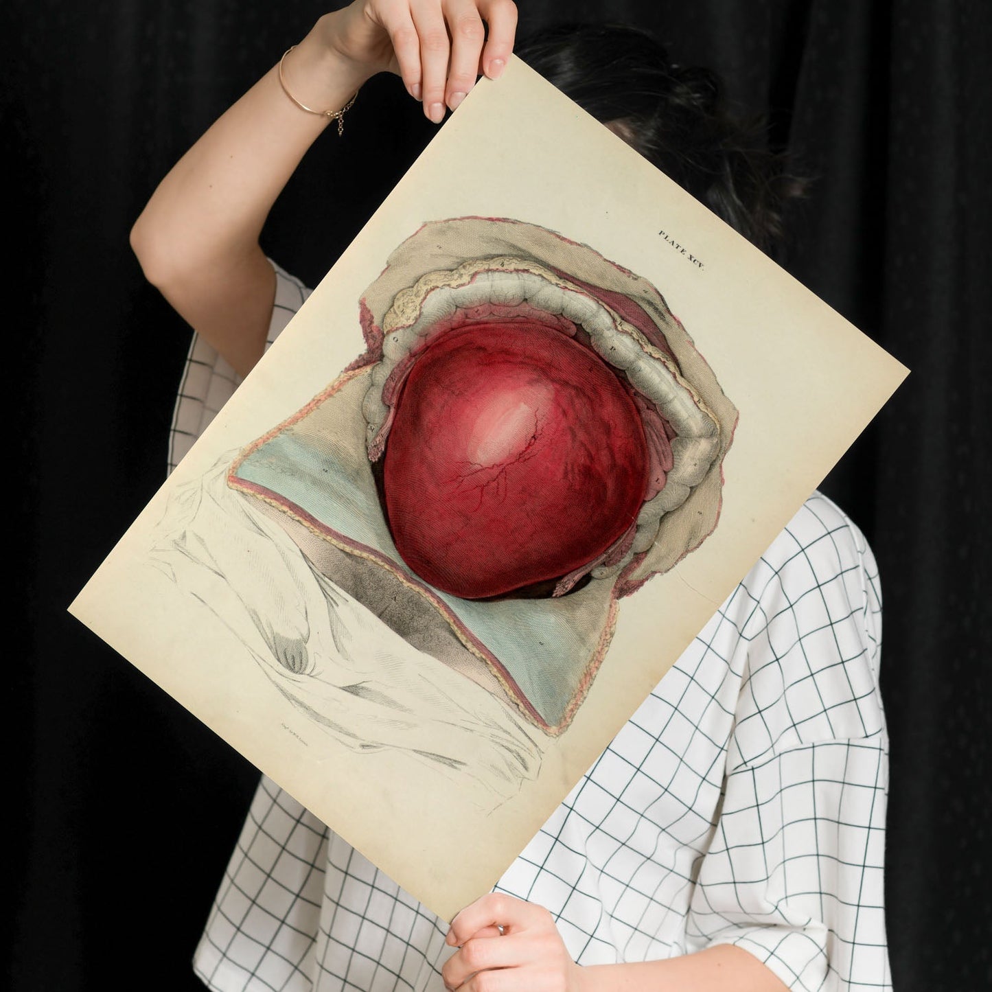 Gravid uterus-Artwork-Nacnic-Nacnic Estudio SL