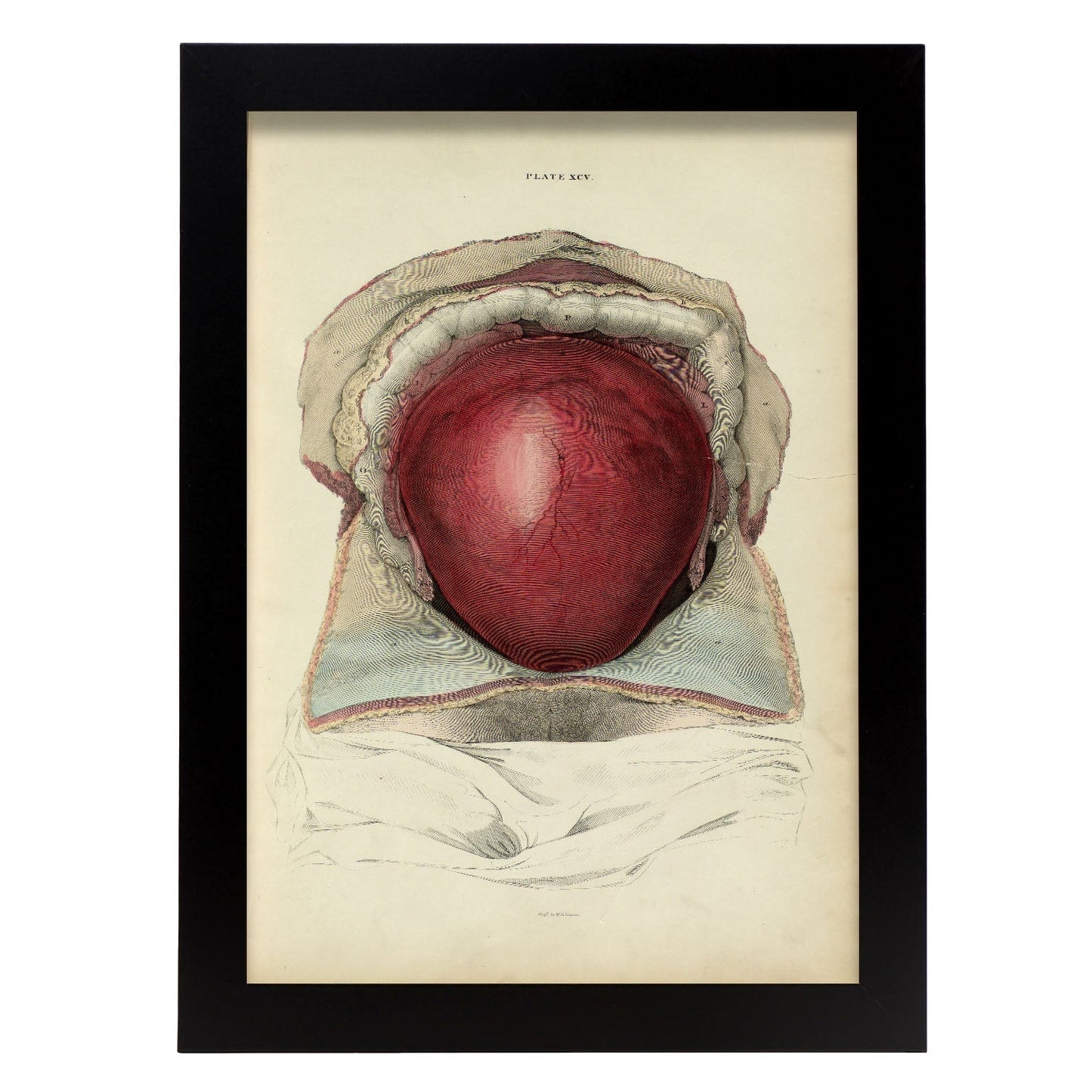 Gravid uterus-Artwork-Nacnic-A4-Sin marco-Nacnic Estudio SL