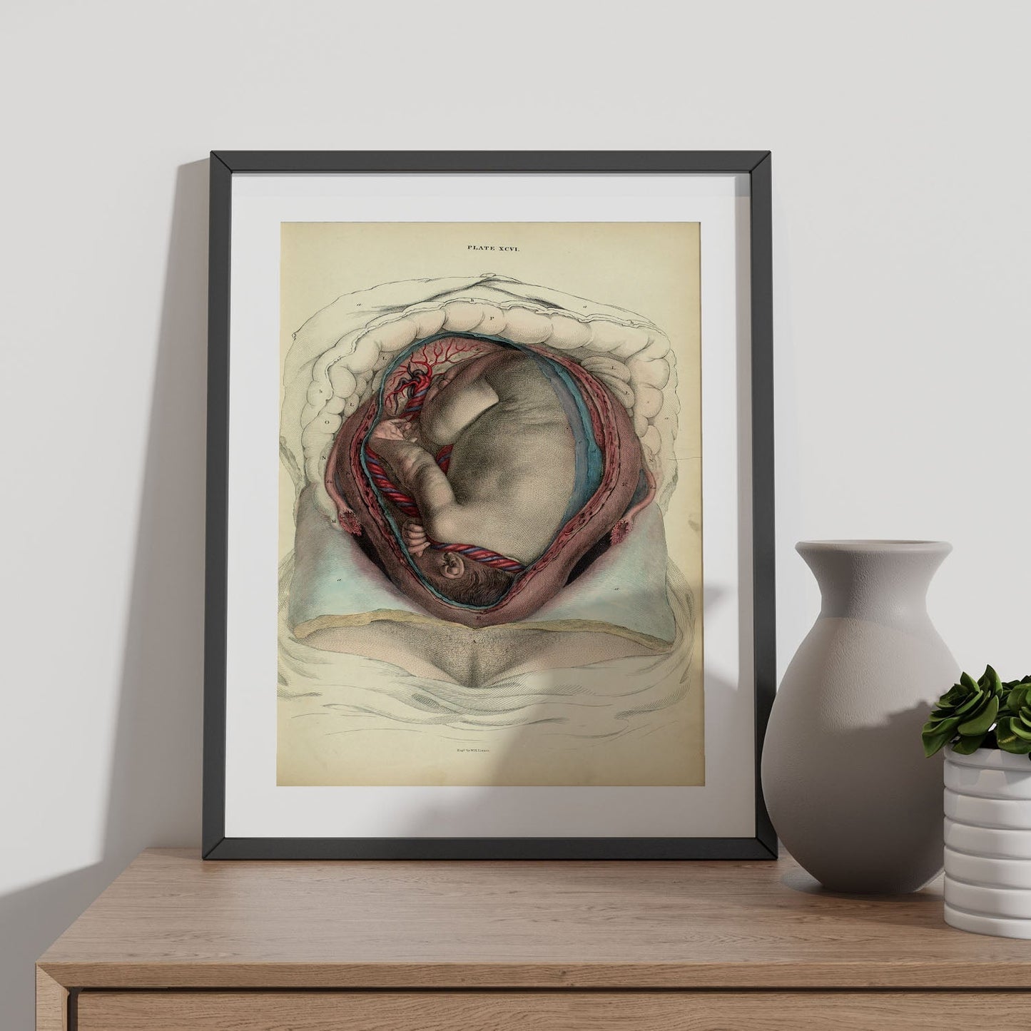 Gravid uterus with fetus-Artwork-Nacnic-Nacnic Estudio SL