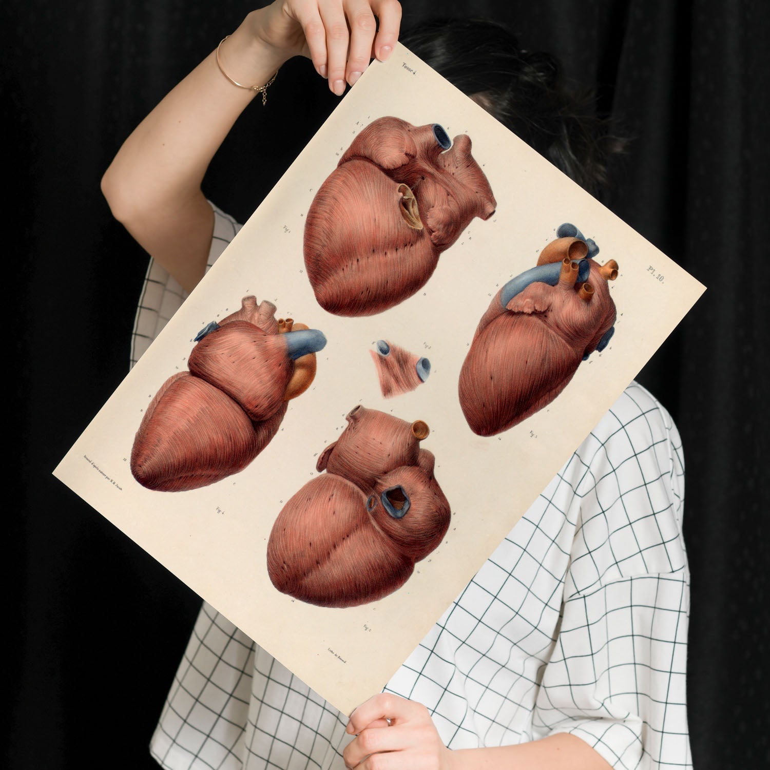 Heart, myocardium-Artwork-Nacnic-Nacnic Estudio SL
