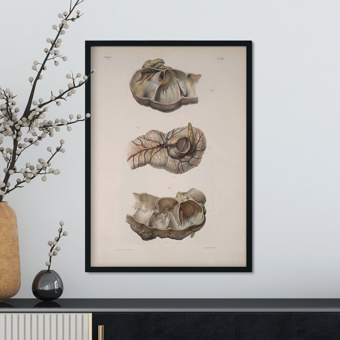 Large intestine; cecum and appendix-Artwork-Nacnic-Nacnic Estudio SL