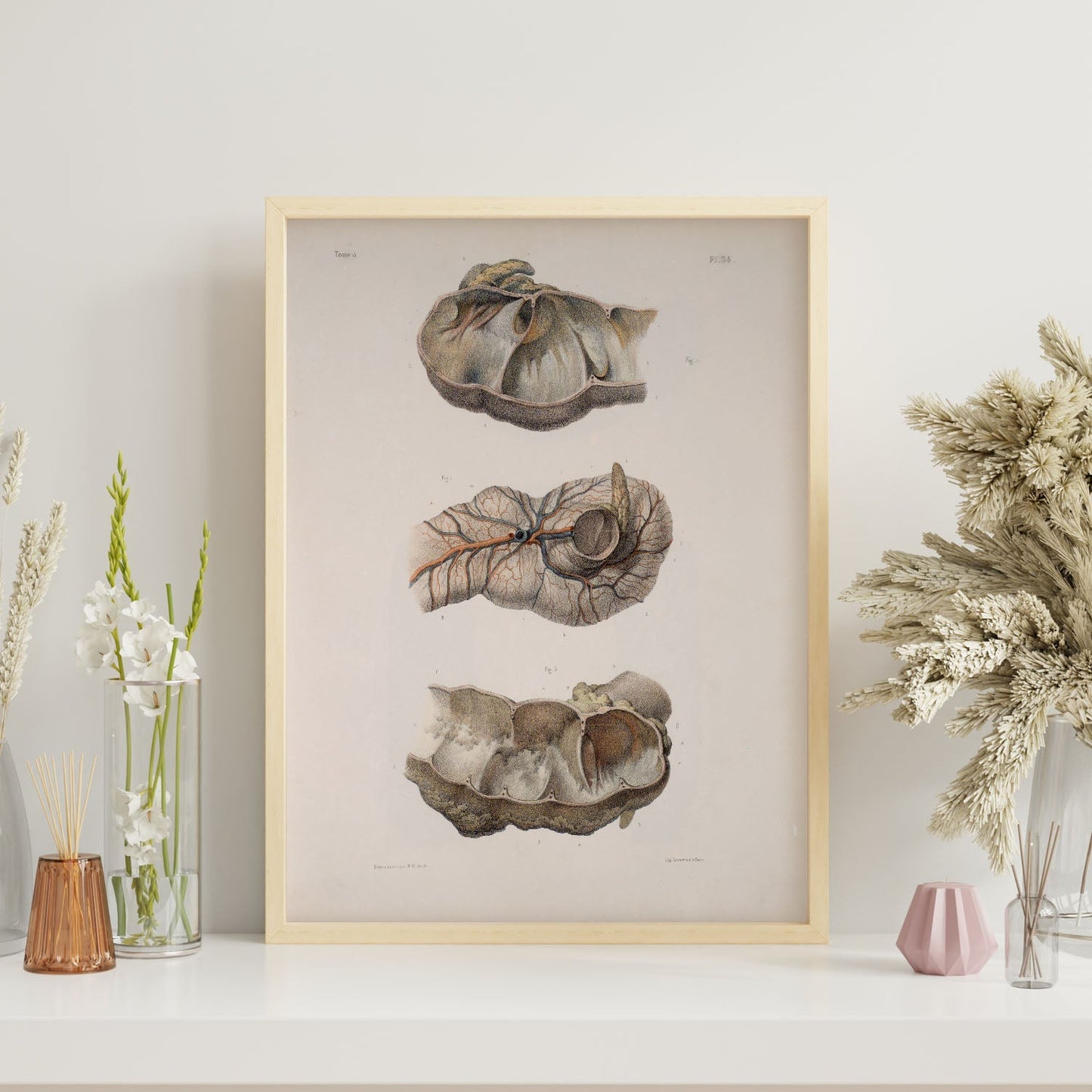 Large intestine; cecum and appendix-Artwork-Nacnic-Nacnic Estudio SL