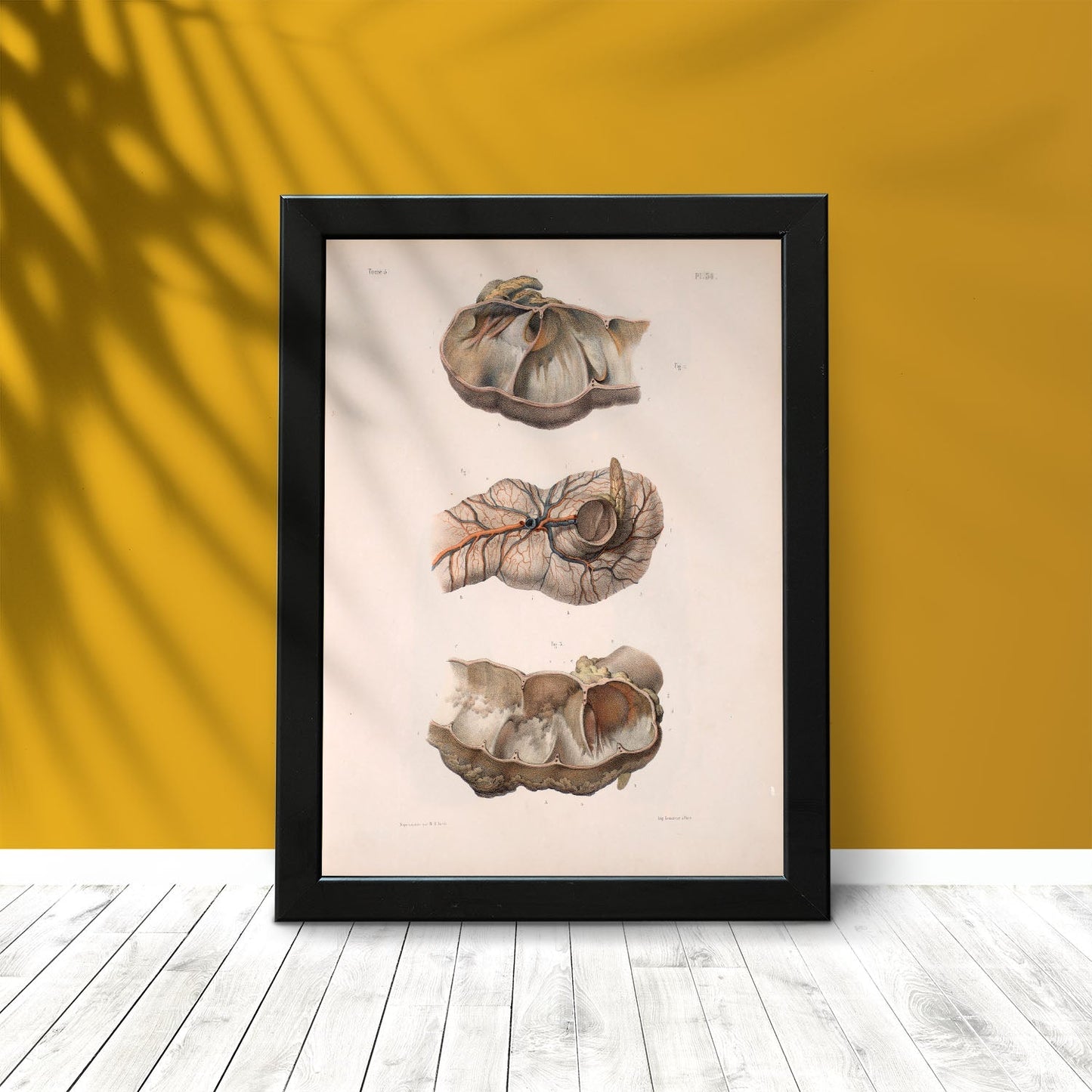 Large intestine; cecum and appendix-Artwork-Nacnic-Nacnic Estudio SL