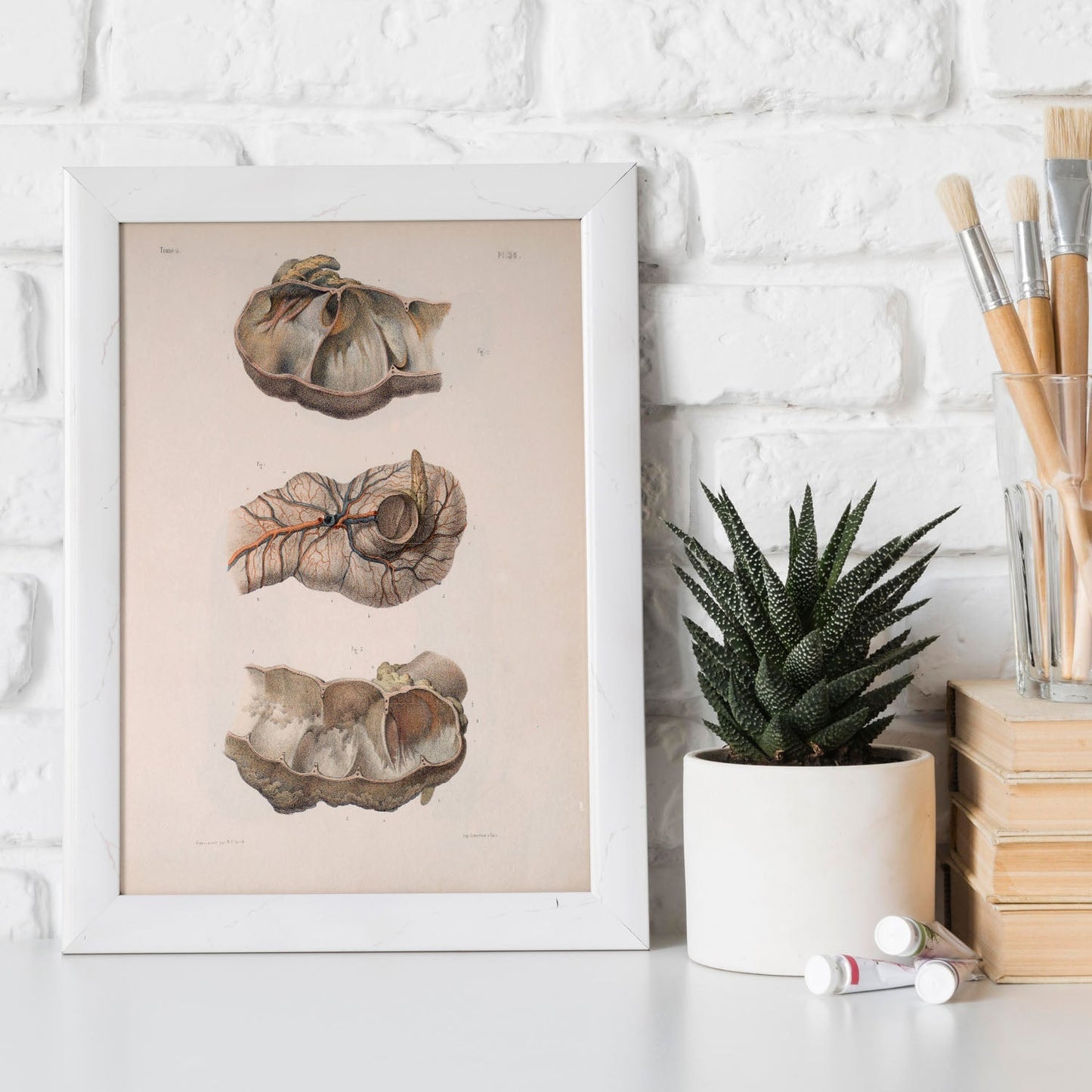 Large intestine; cecum and appendix-Artwork-Nacnic-Nacnic Estudio SL