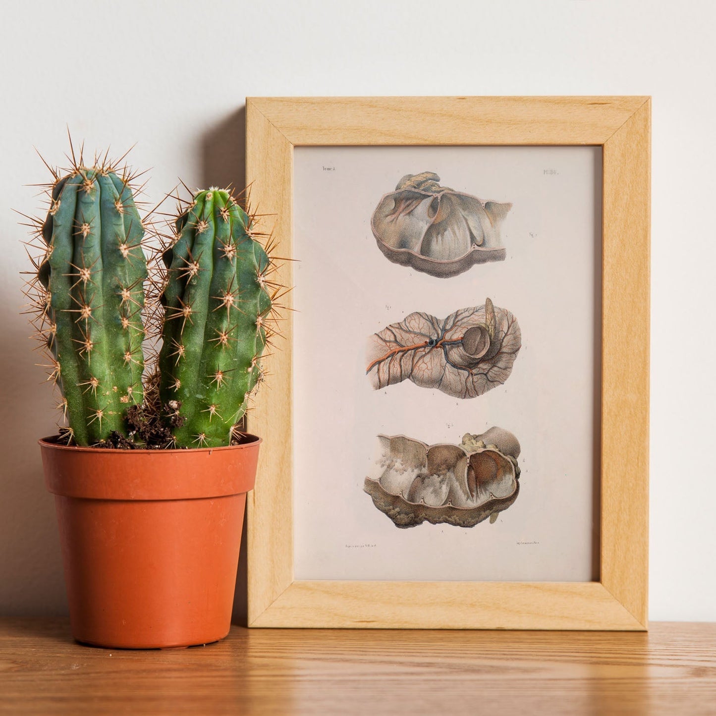 Large intestine; cecum and appendix-Artwork-Nacnic-Nacnic Estudio SL
