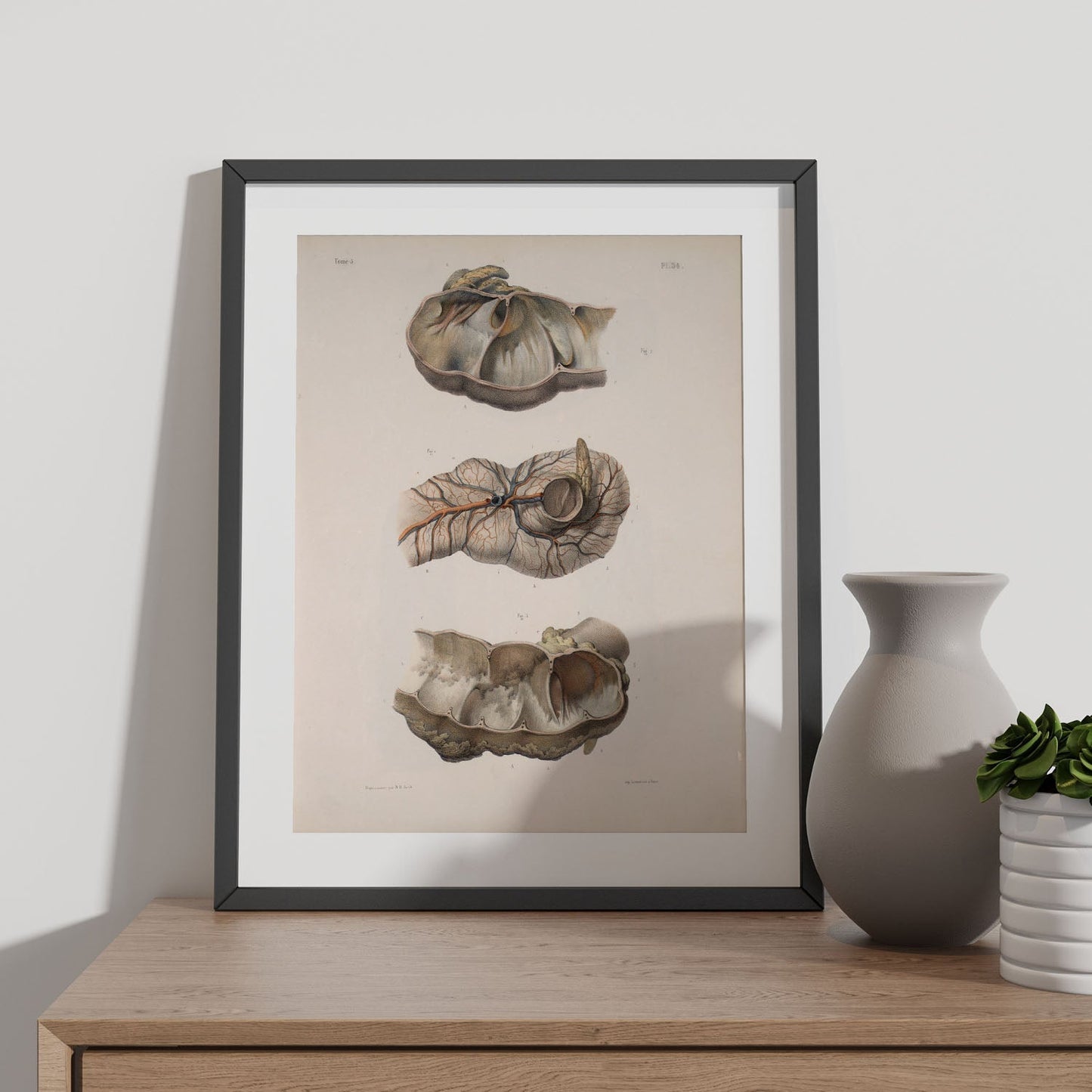 Large intestine; cecum and appendix-Artwork-Nacnic-Nacnic Estudio SL