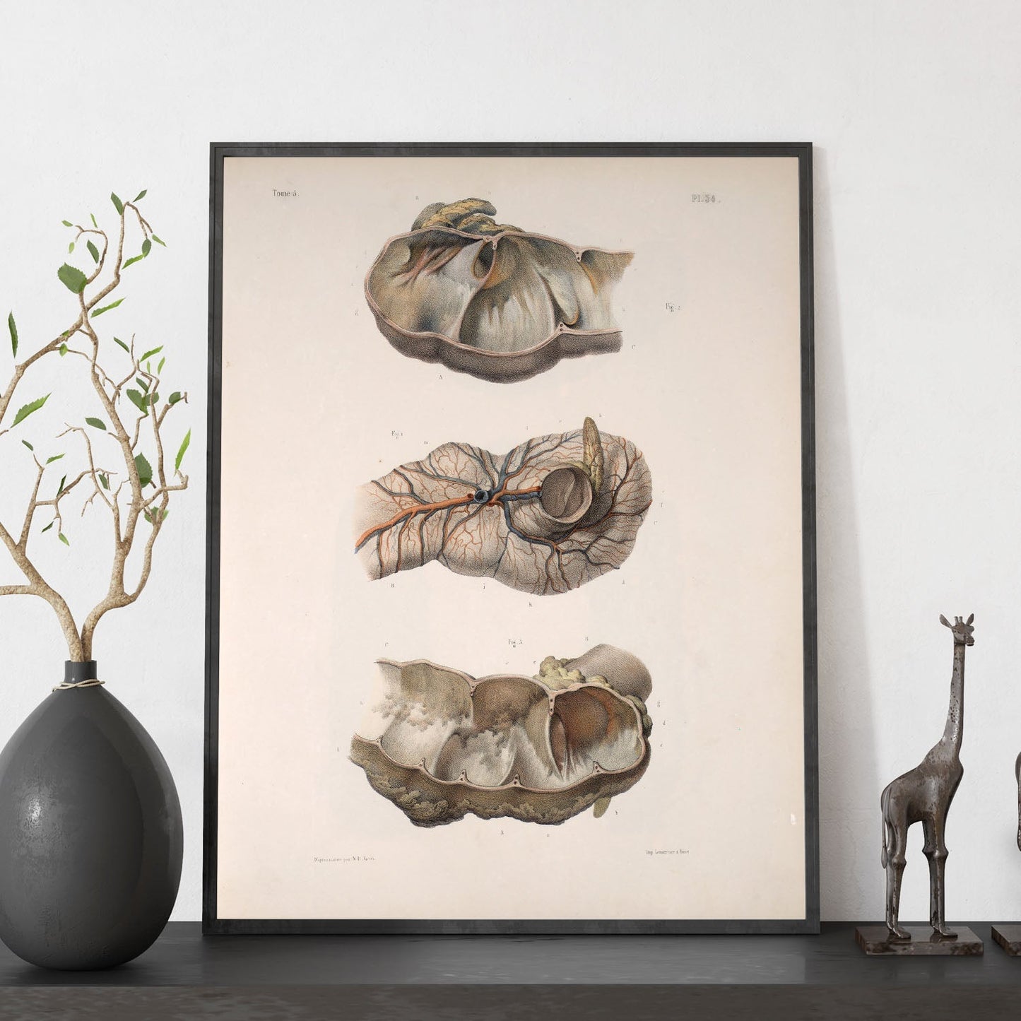Large intestine; cecum and appendix-Artwork-Nacnic-Nacnic Estudio SL