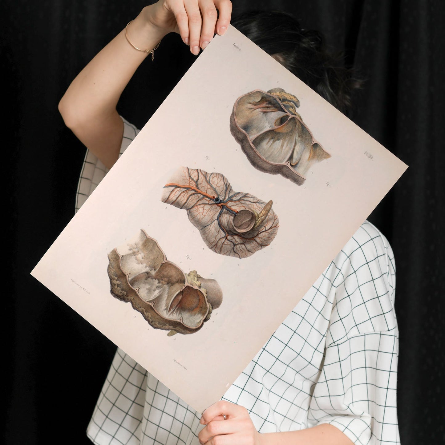 Large intestine; cecum and appendix-Artwork-Nacnic-Nacnic Estudio SL