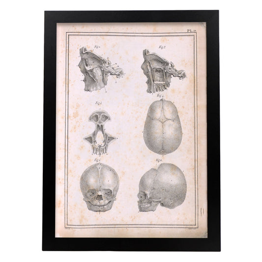 Paillou Fetal skull-Artwork-Nacnic-A3-Sin marco-Nacnic Estudio SL