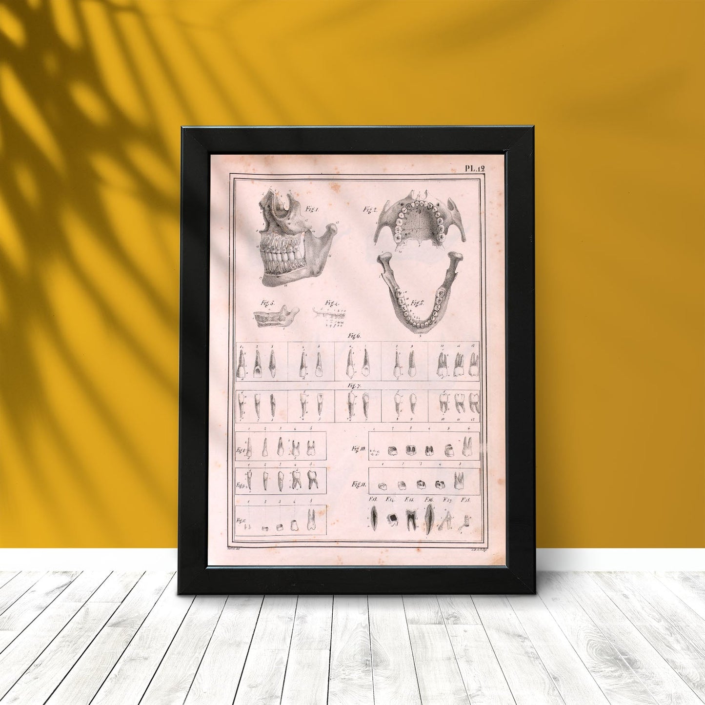 Paillou Teeth, maxilla and mandible-Artwork-Nacnic-Nacnic Estudio SL