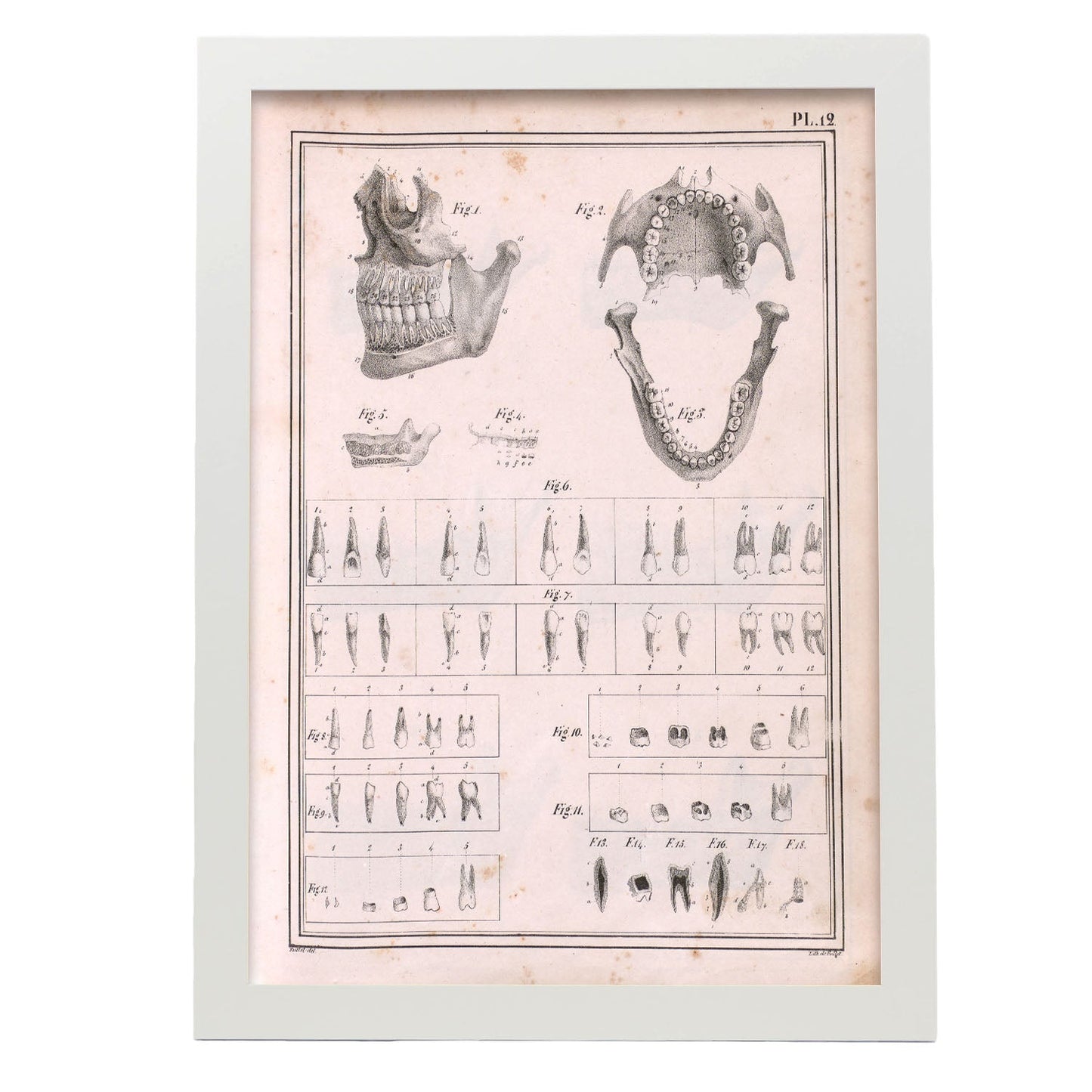 Paillou Teeth, maxilla and mandible-Artwork-Nacnic-A3-Marco Blanco-Nacnic Estudio SL