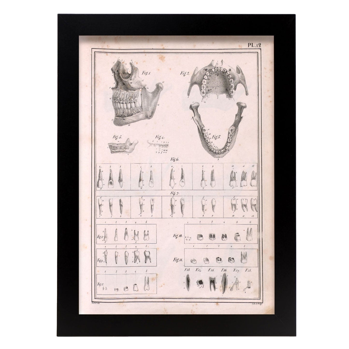 Paillou Teeth, maxilla and mandible-Artwork-Nacnic-A4-Sin marco-Nacnic Estudio SL