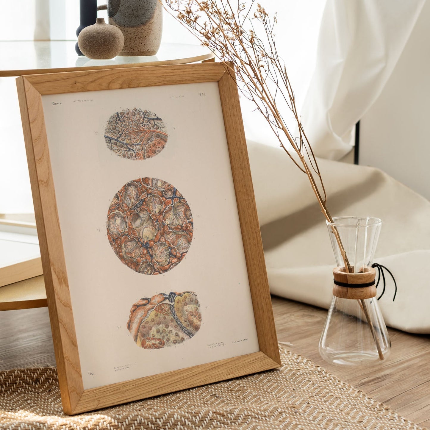 Spleen, splenic artery and vein-Artwork-Nacnic-Nacnic Estudio SL