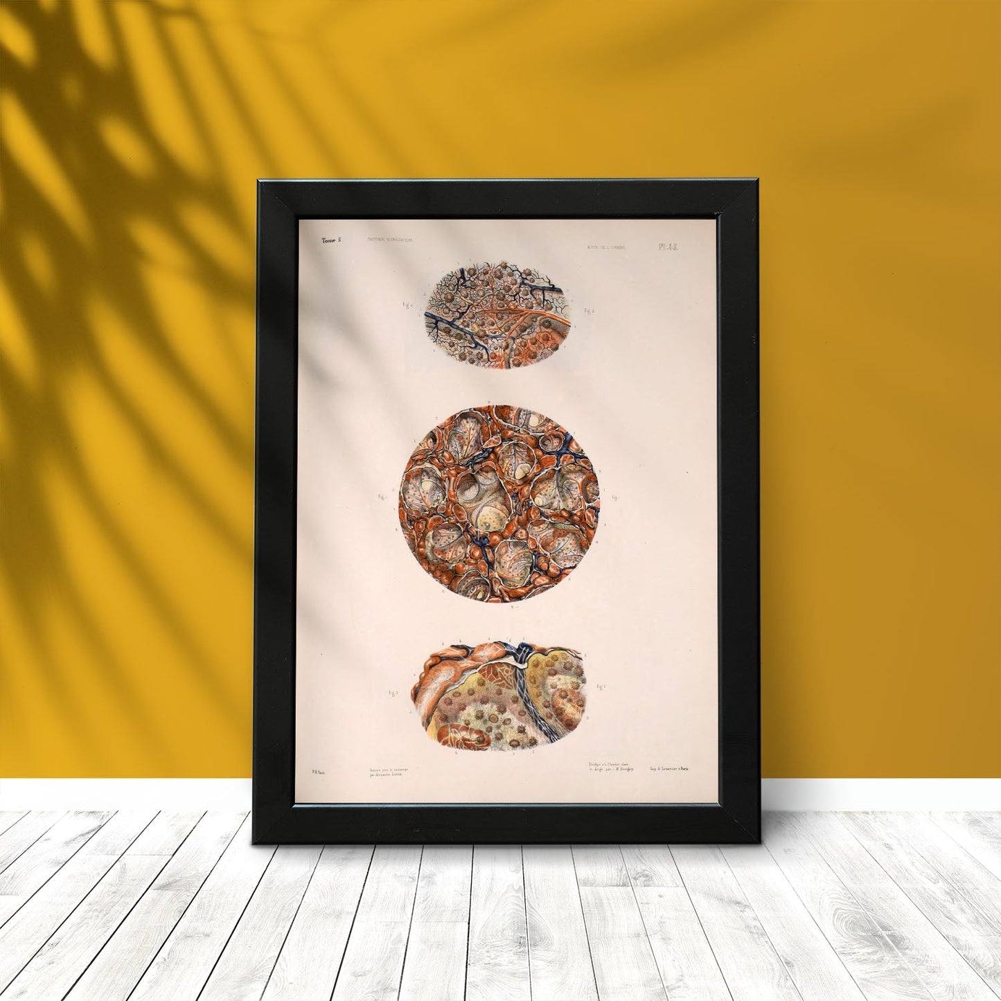 Spleen, splenic artery and vein-Artwork-Nacnic-Nacnic Estudio SL