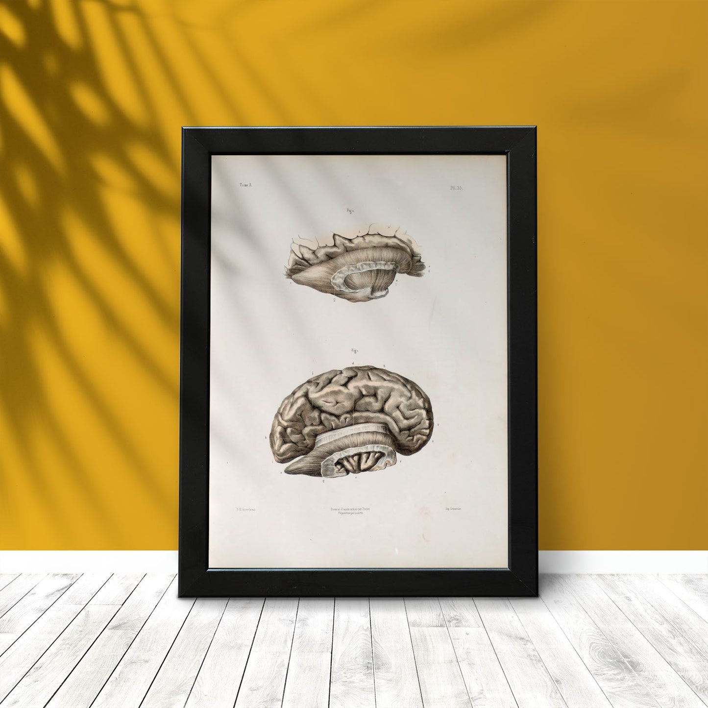 Brain divided in parasagital section-Artwork-Nacnic-Nacnic Estudio SL