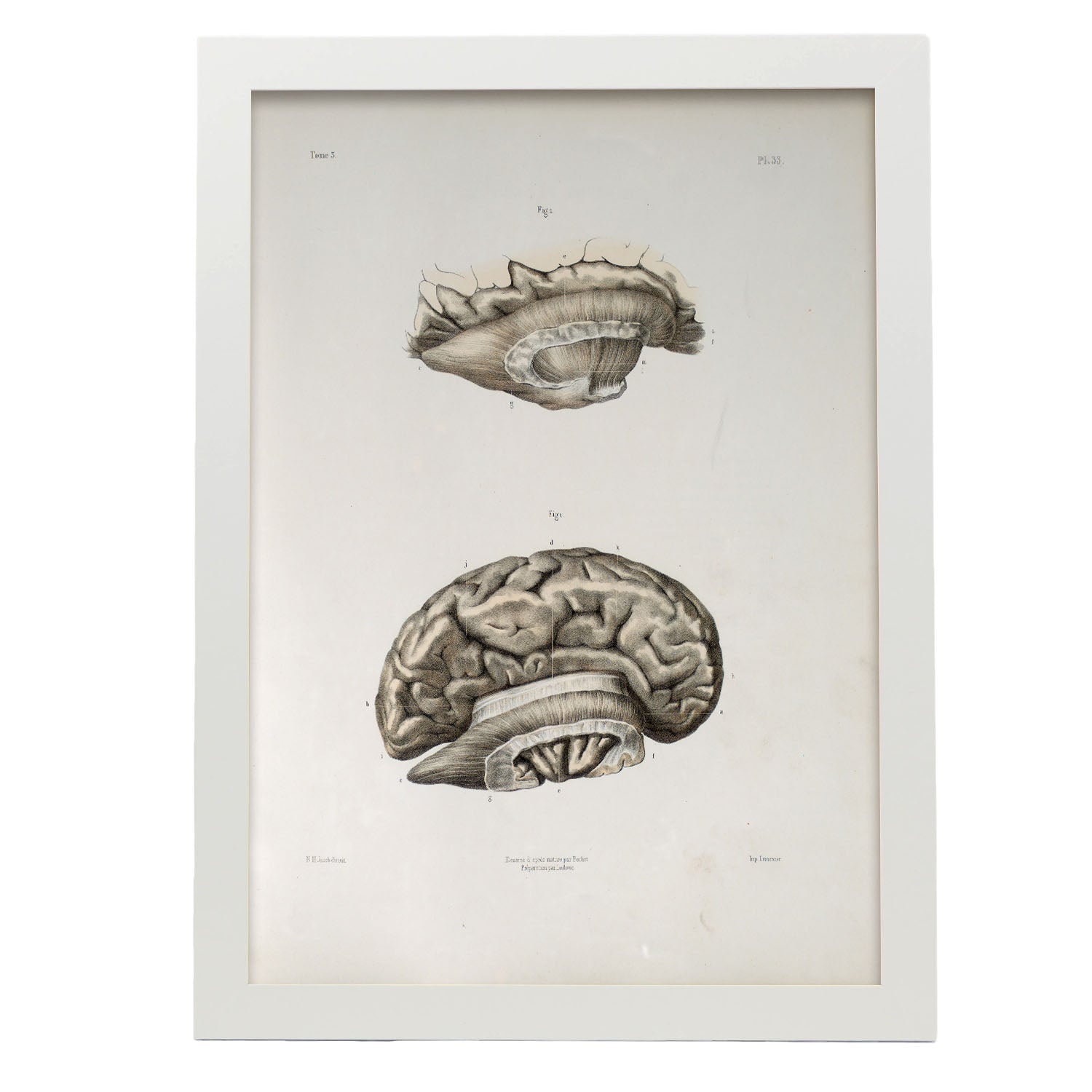 Brain divided in parasagital section-Artwork-Nacnic-A3-Marco Blanco-Nacnic Estudio SL