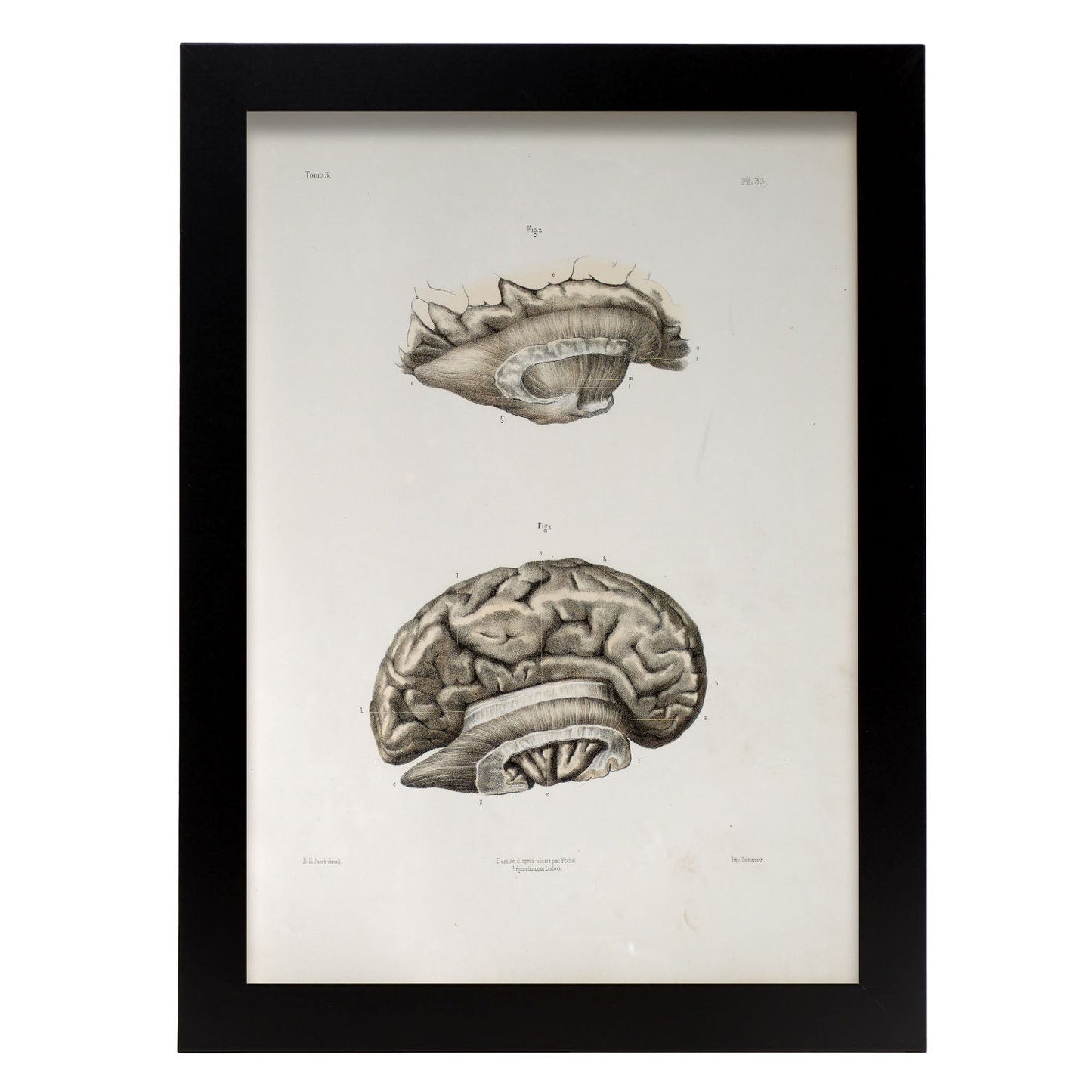 Brain divided in parasagital section-Artwork-Nacnic-A3-Marco Negro-Nacnic Estudio SL